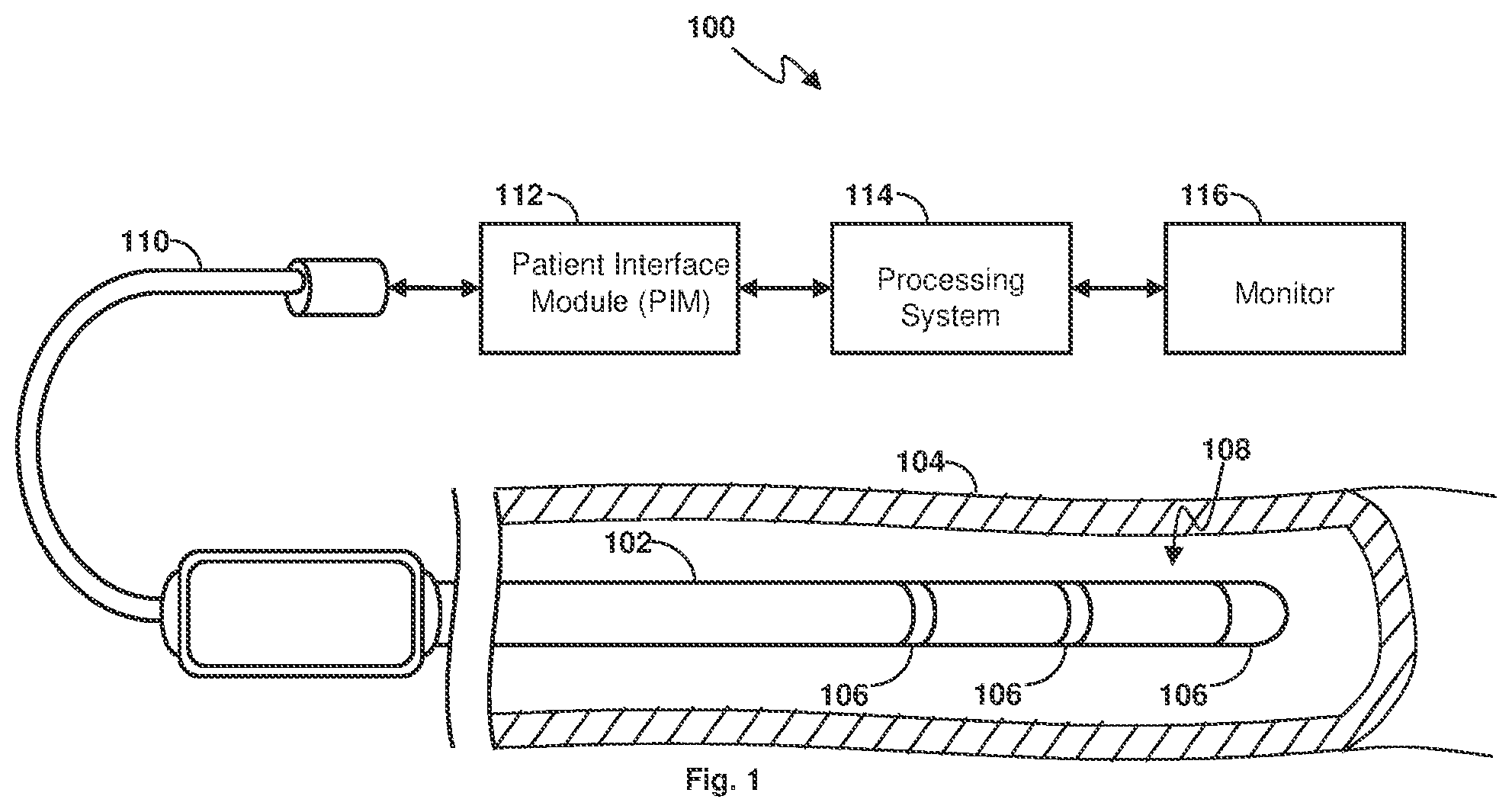 Patent US12167931 Figure 1 – Sensor interface device providing digital processing of intravascular flow and pressure data