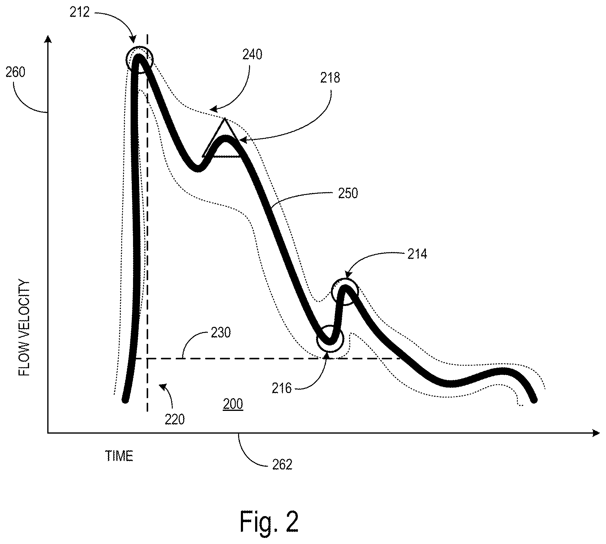 Patent US12167932 Figure 2 – Categorization of ultrasound waveforms through morphological variables