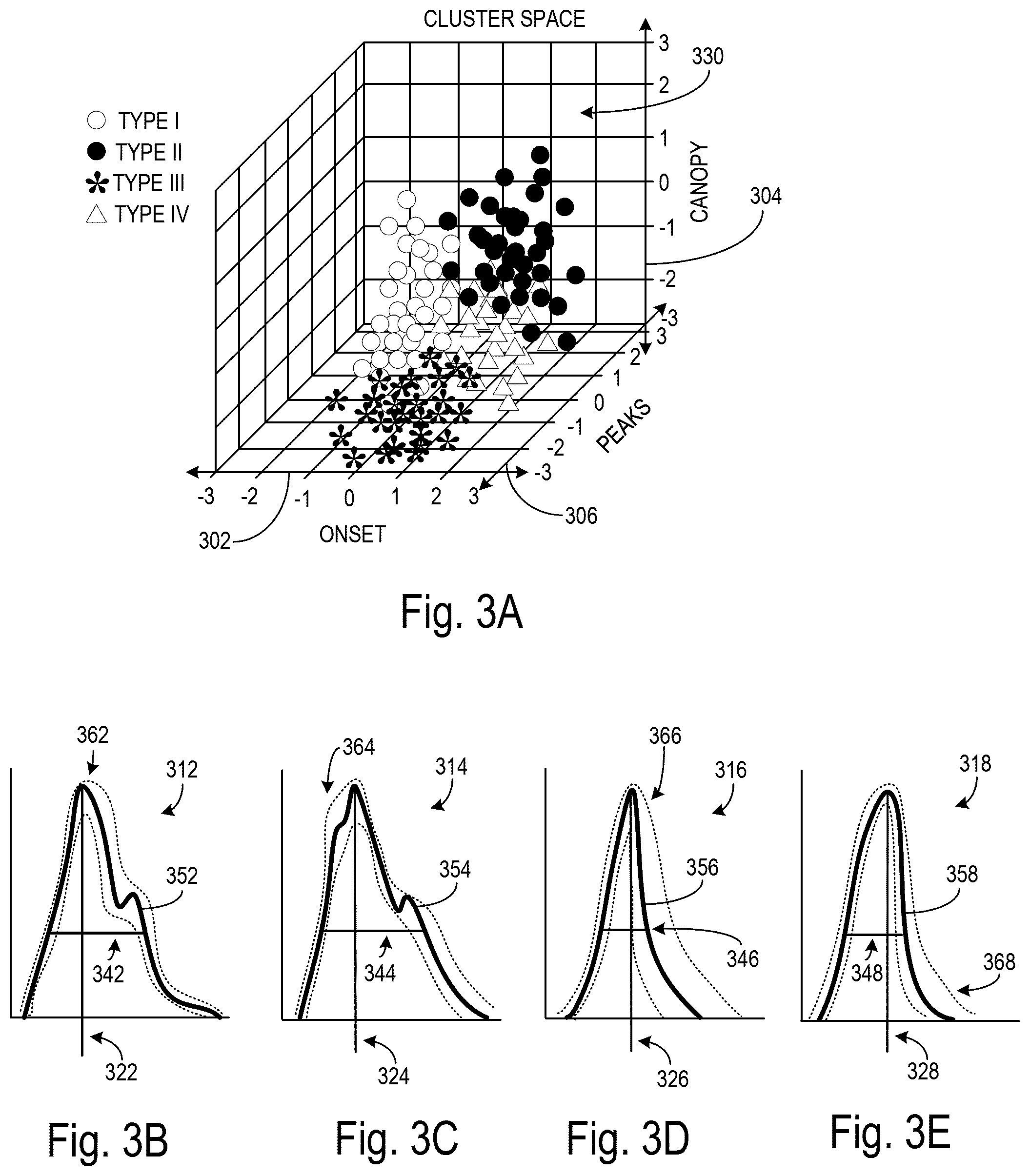 Patent US12167932 Figure 3 – Categorization of ultrasound waveforms through morphological variables