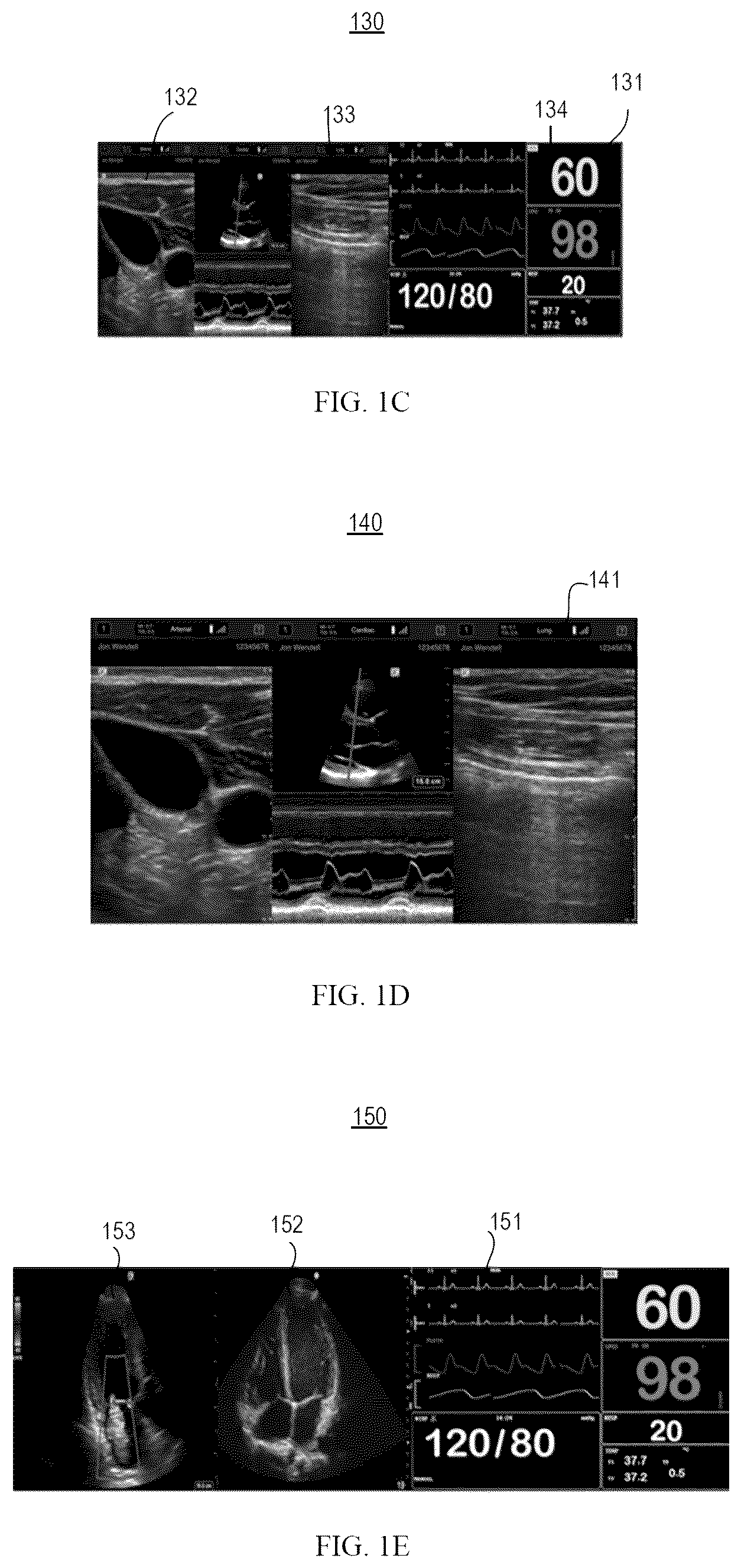 Patent US12167935 Figure 3 – Ultrasound system for a virtual sonography team