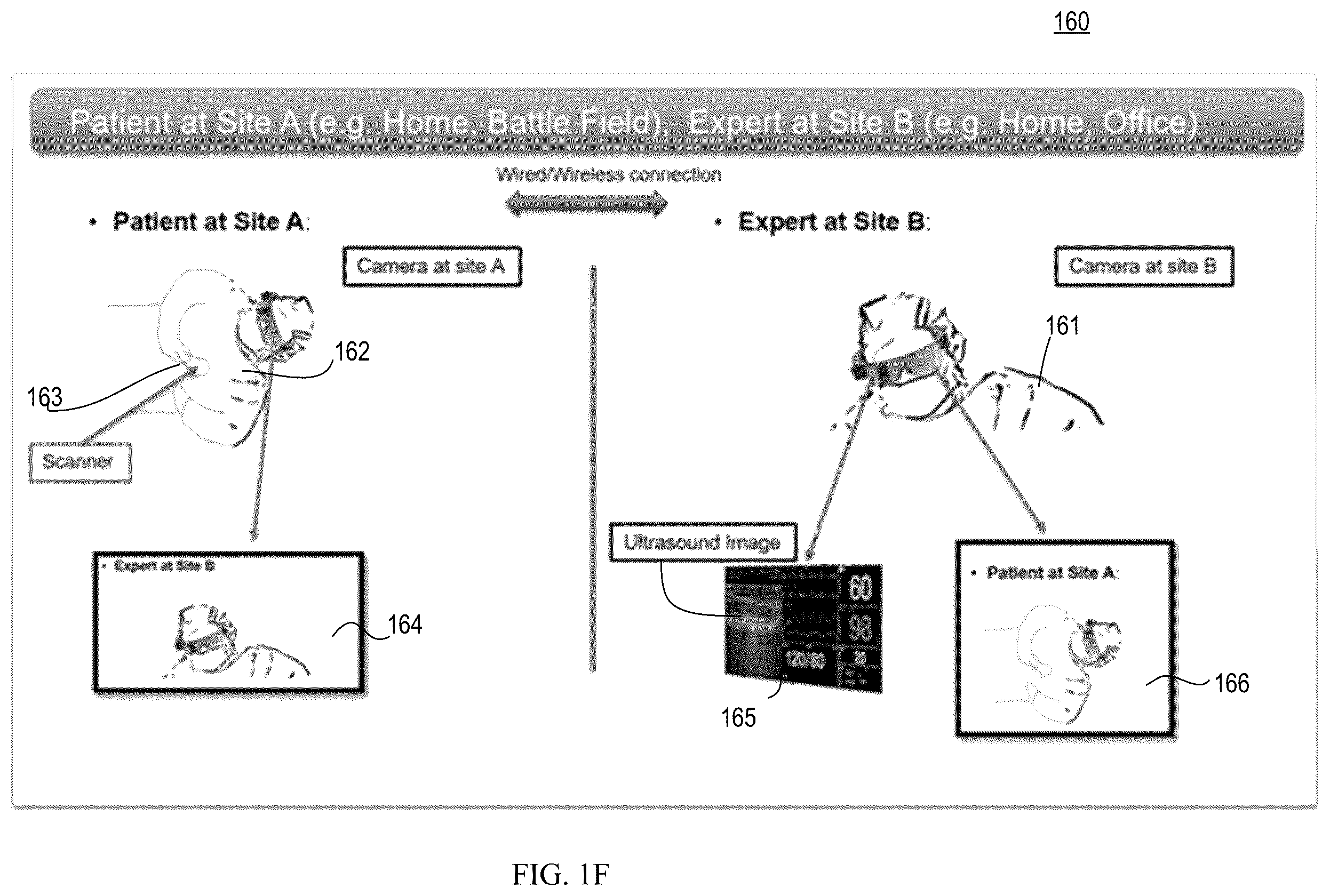 Patent US12167935 Figure 4 – Ultrasound system for a virtual sonography team
