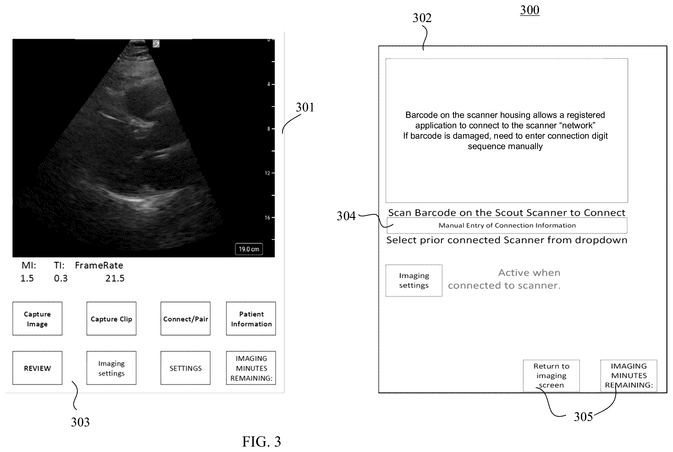 Patent US12167935 Figure 6 – Ultrasound system for a virtual sonography team