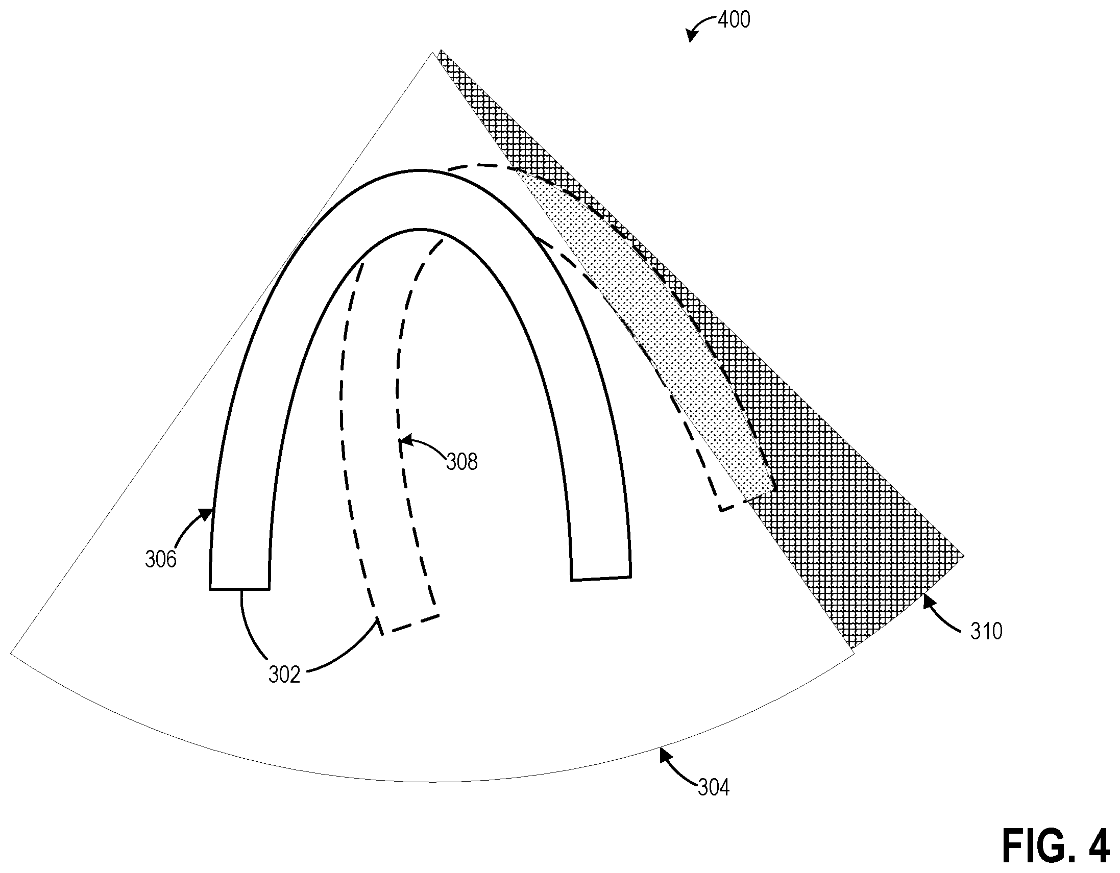 Patent US12167937 Figure 4 – Methods and systems for live image acquisition