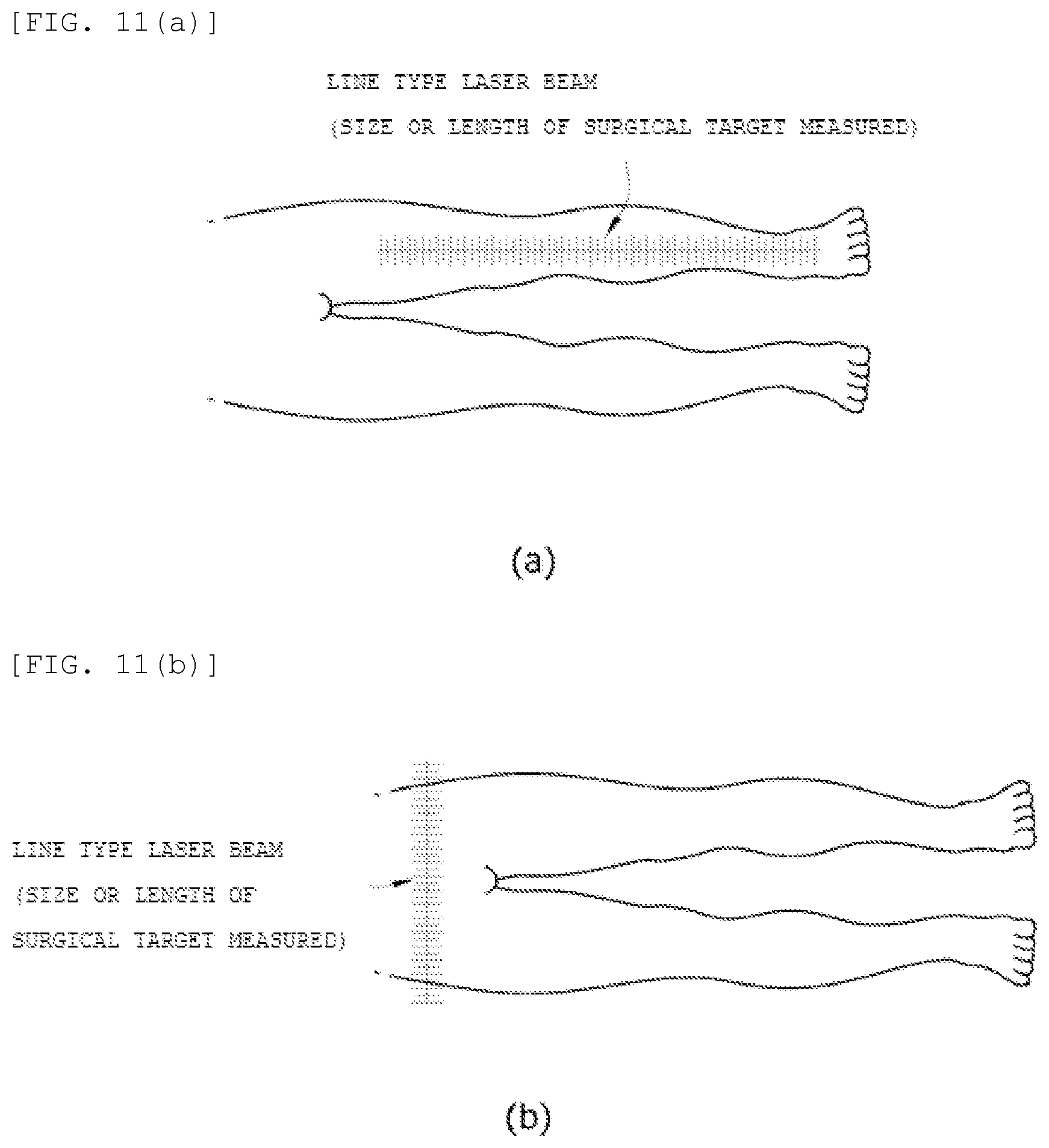 Patent US12167938 Figure 13 – Multipurpose laser pointing-equipment for medical use