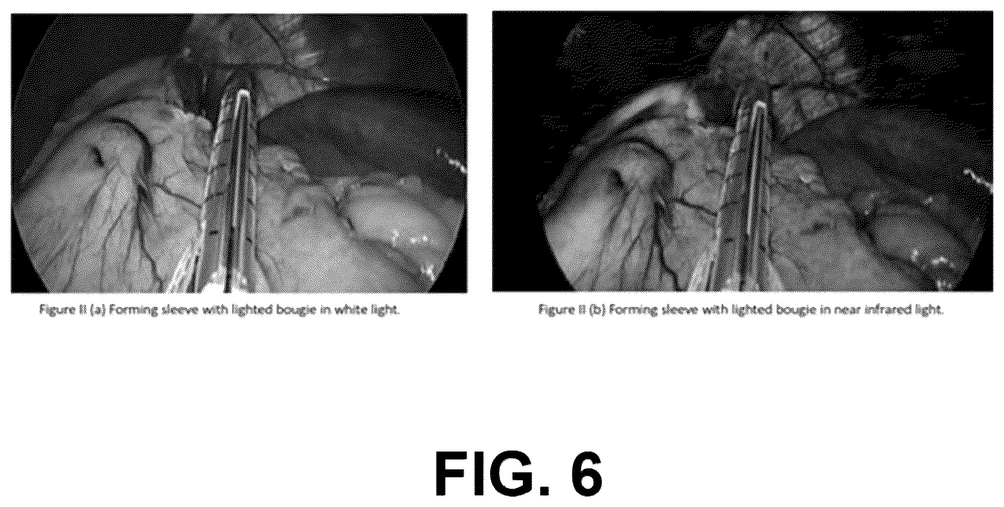 Patent US12167939 Figure 5 – Surgical devices and methods for bariatric and gastroesophageal surgery