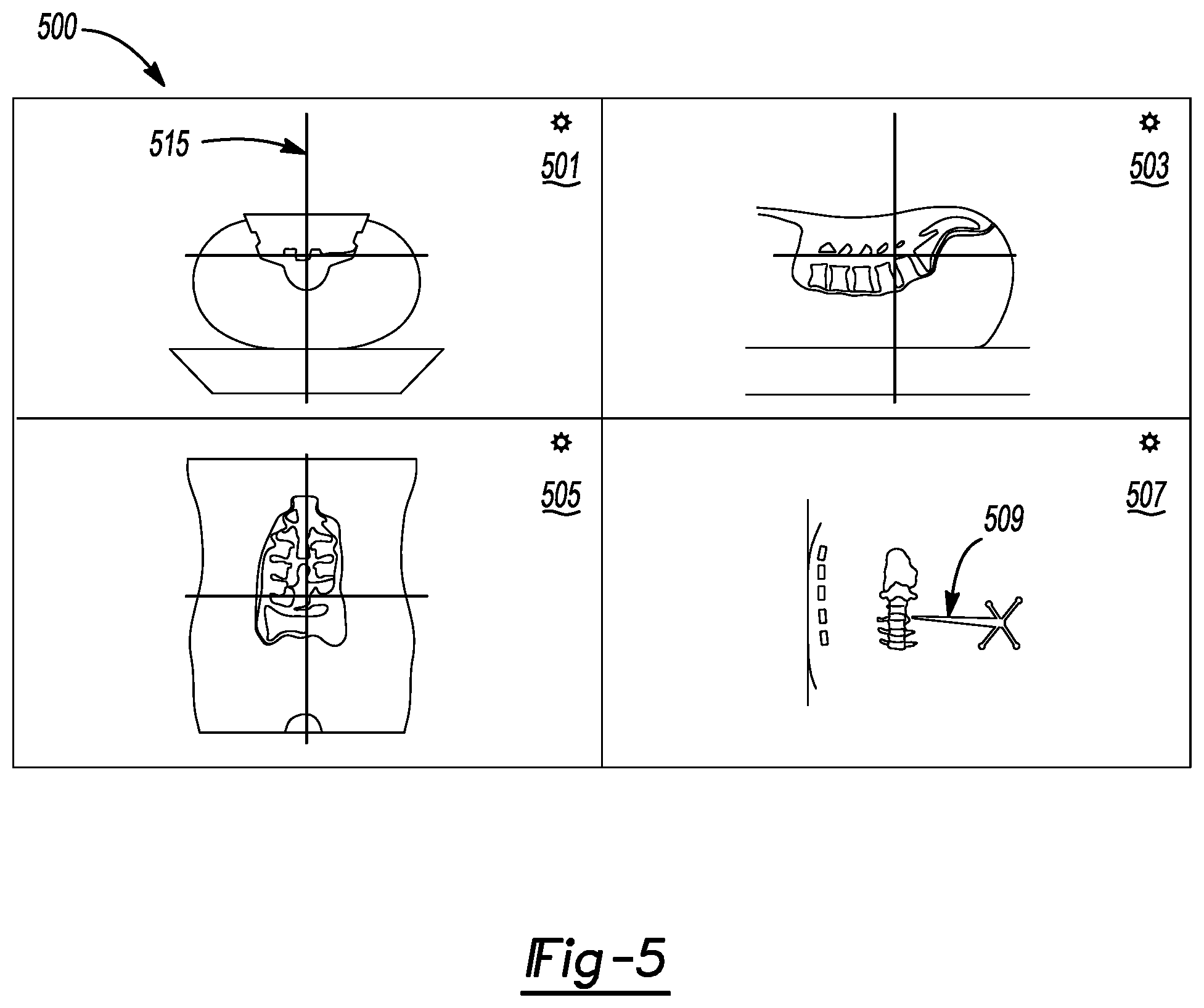 Patent US12167940 Figure 5 – Methods and systems for display of patient data in computer-assisted surgery