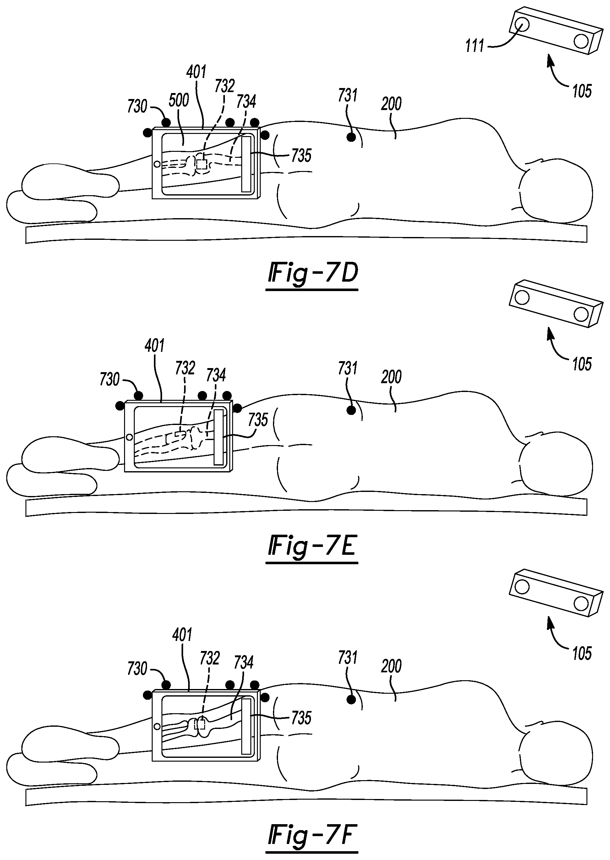 Patent US12167940 Figure 8 – Methods and systems for display of patient data in computer-assisted surgery