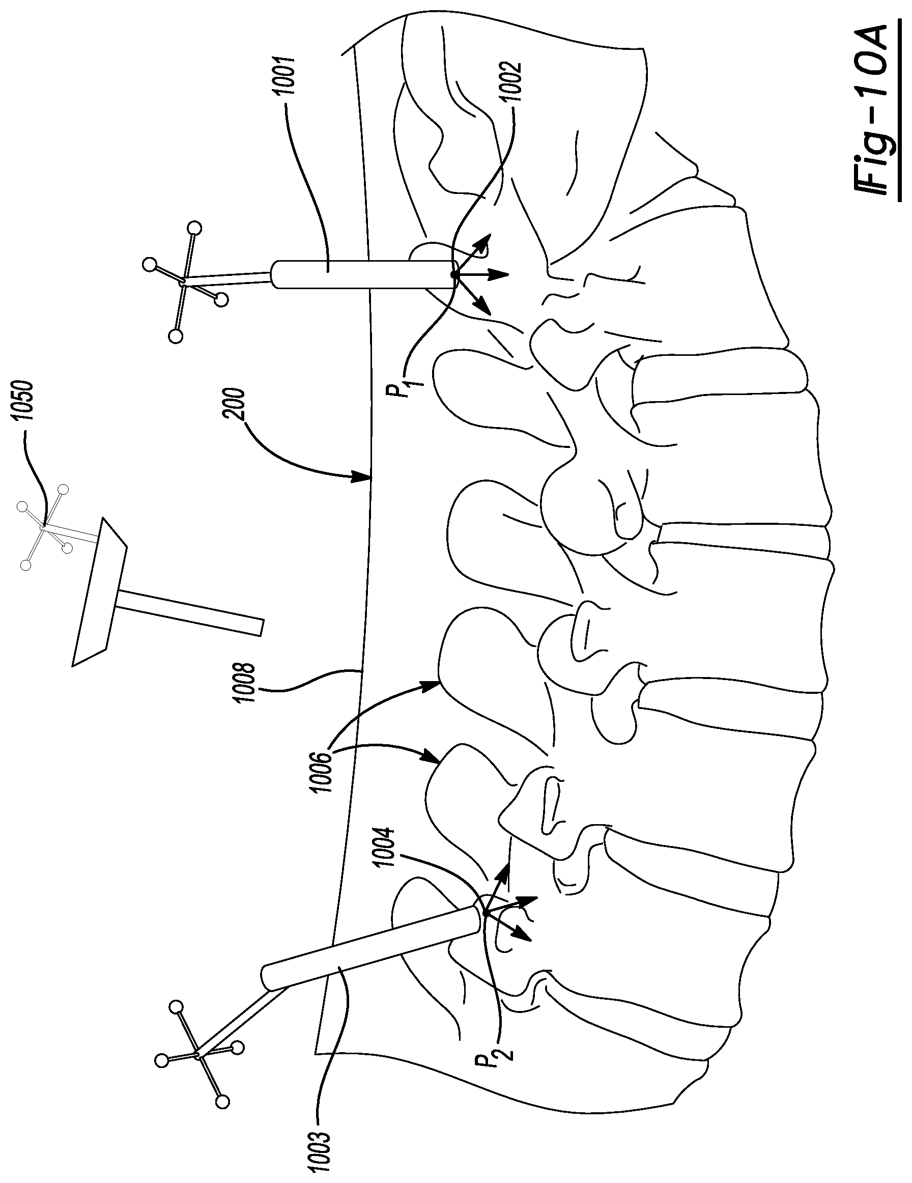 Patent US12167940 Figure 12 – Methods and systems for display of patient data in computer-assisted surgery