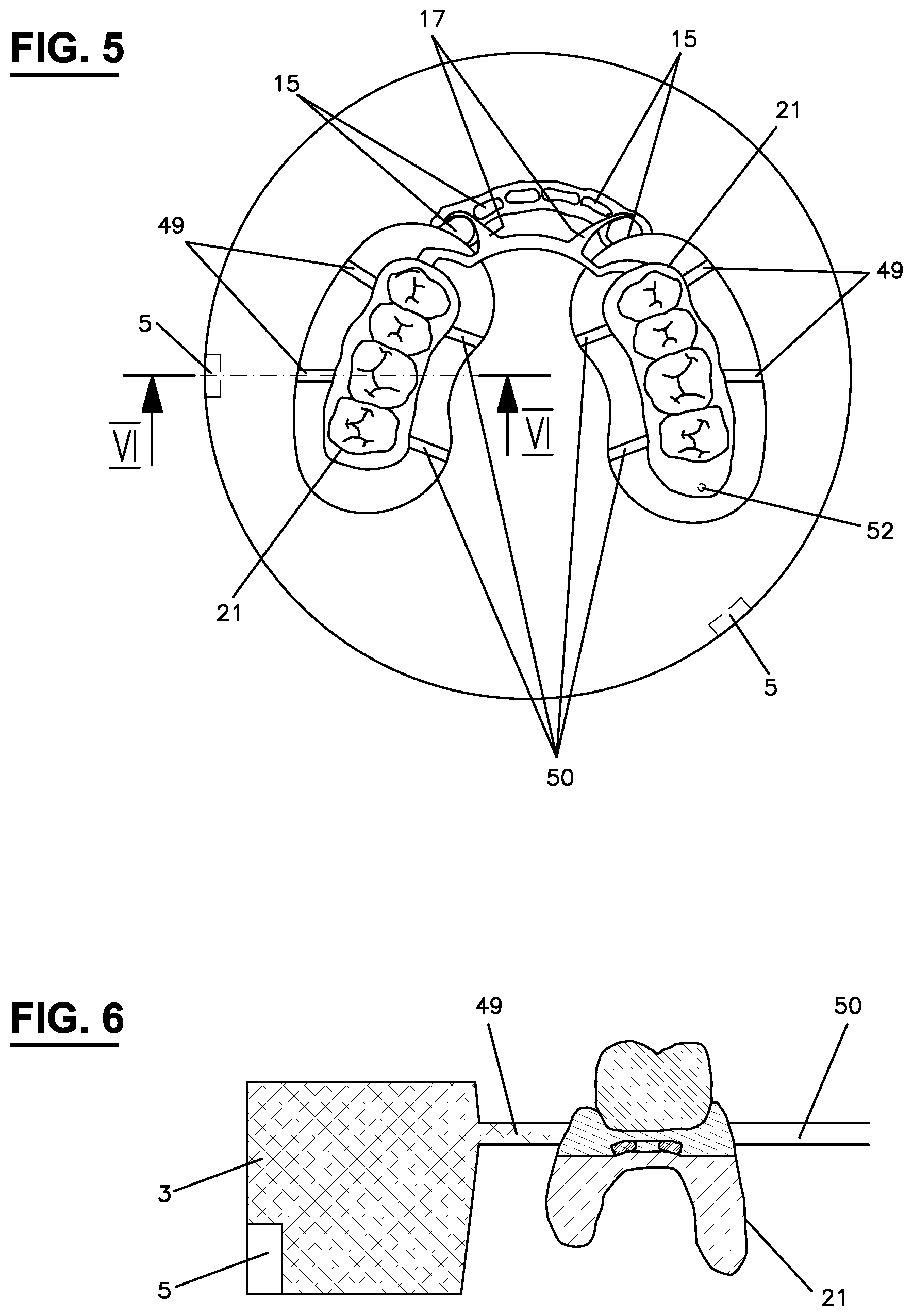 Patent US12167946 Figure 3 – Method for producing a molded body and molded body