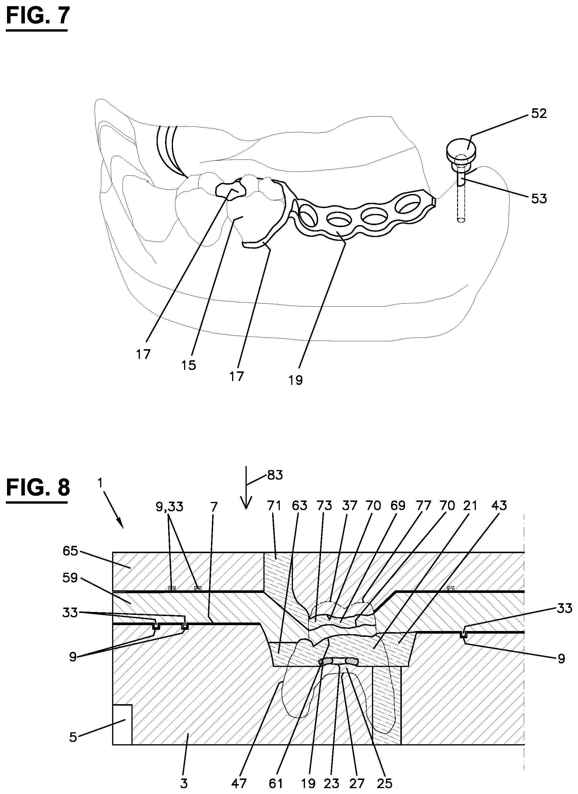 Patent US12167946 Figure 4 – Method for producing a molded body and molded body