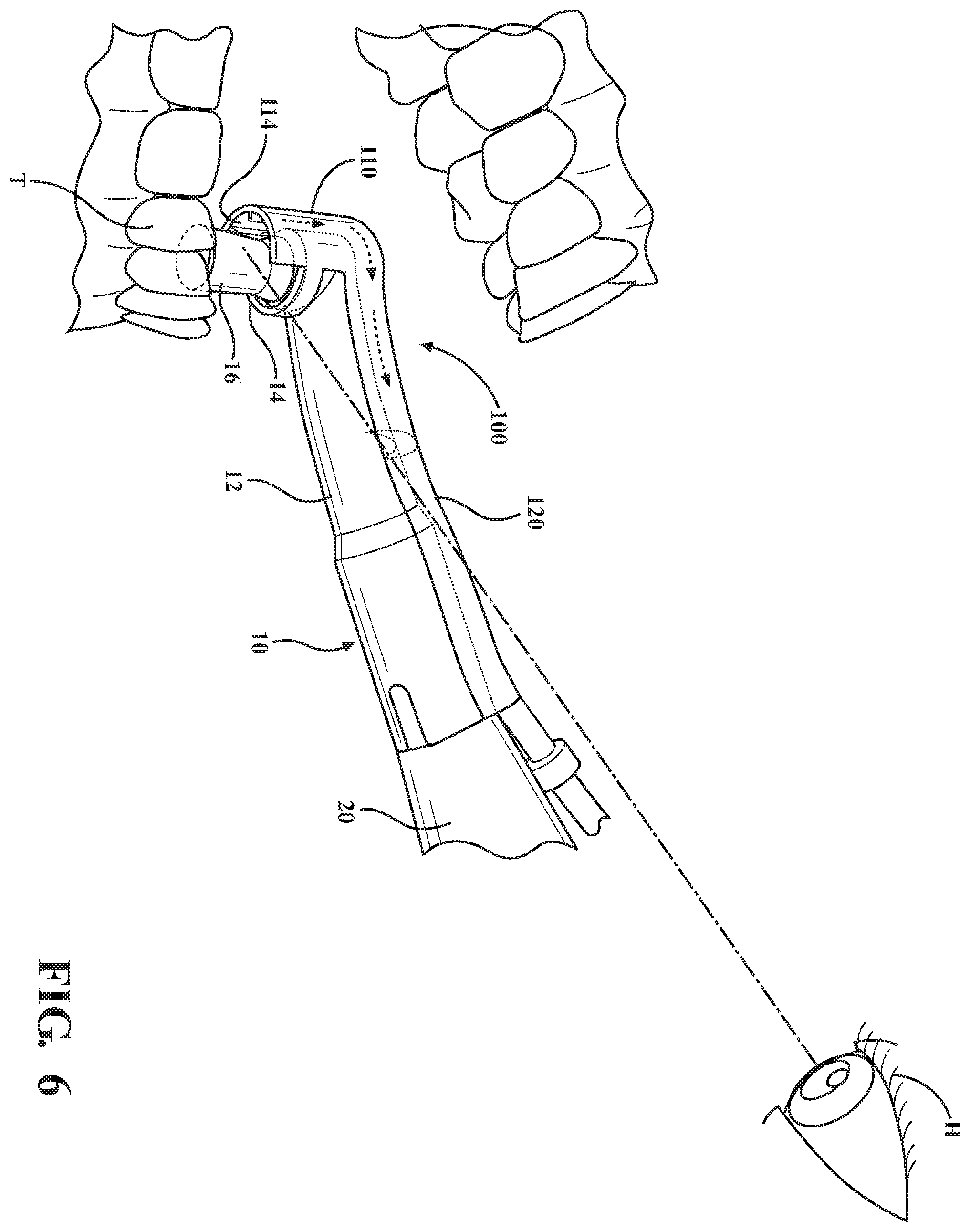 Patent US12167947 Figure 5 – Suction hood for dental prophy angle