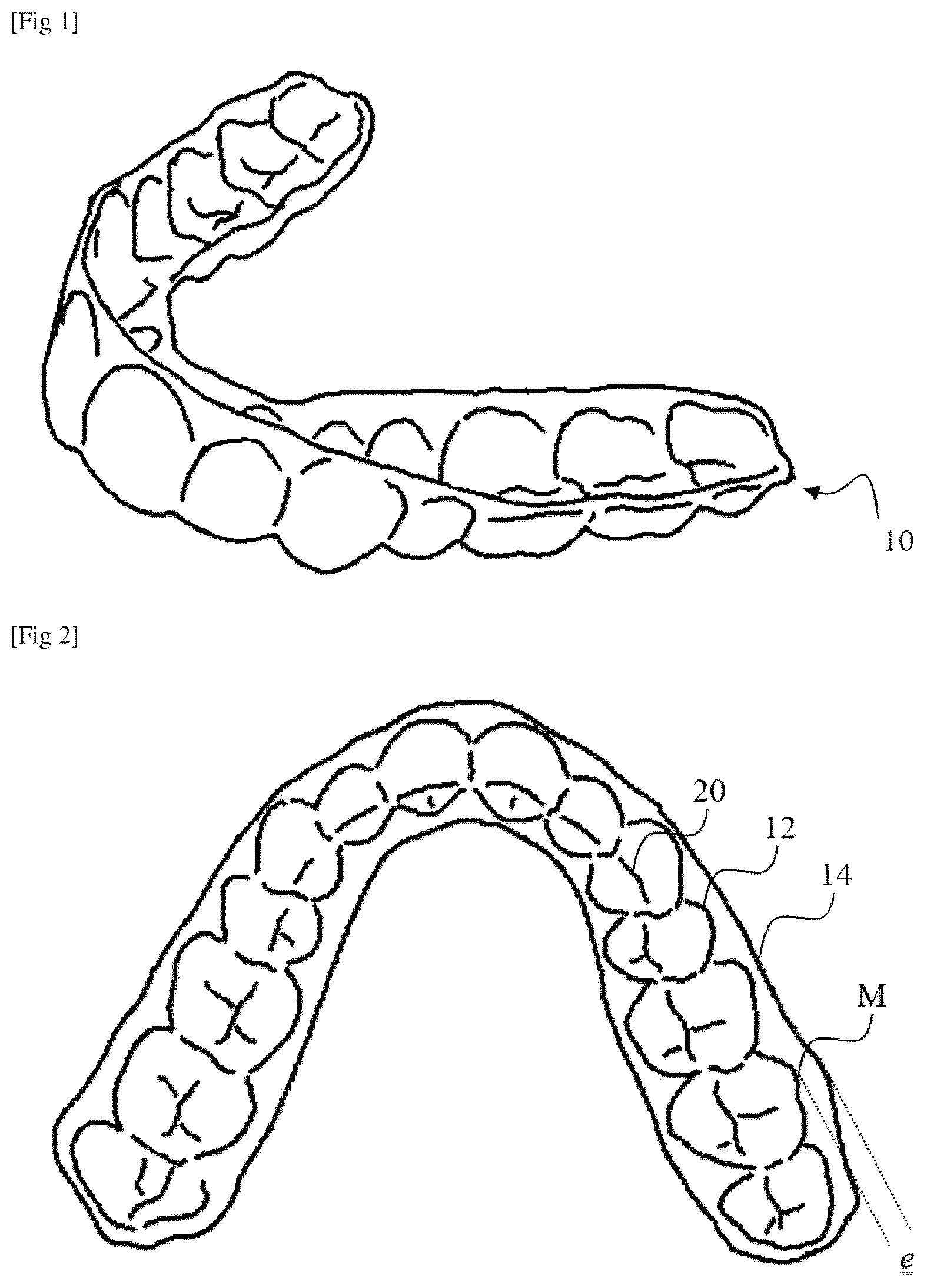 Patent US12167949 Figure 1 – Method for evaluating an orthodontic aligner