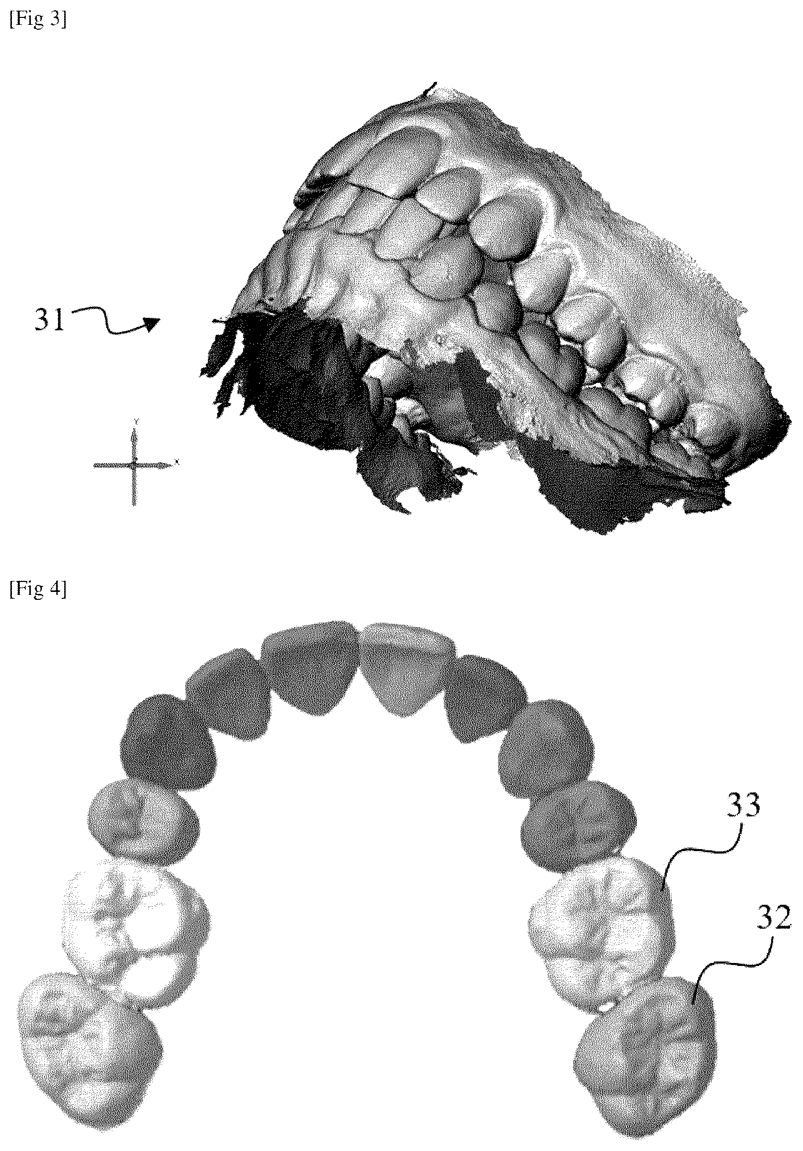 Patent US12167949 Figure 2 – Method for evaluating an orthodontic aligner