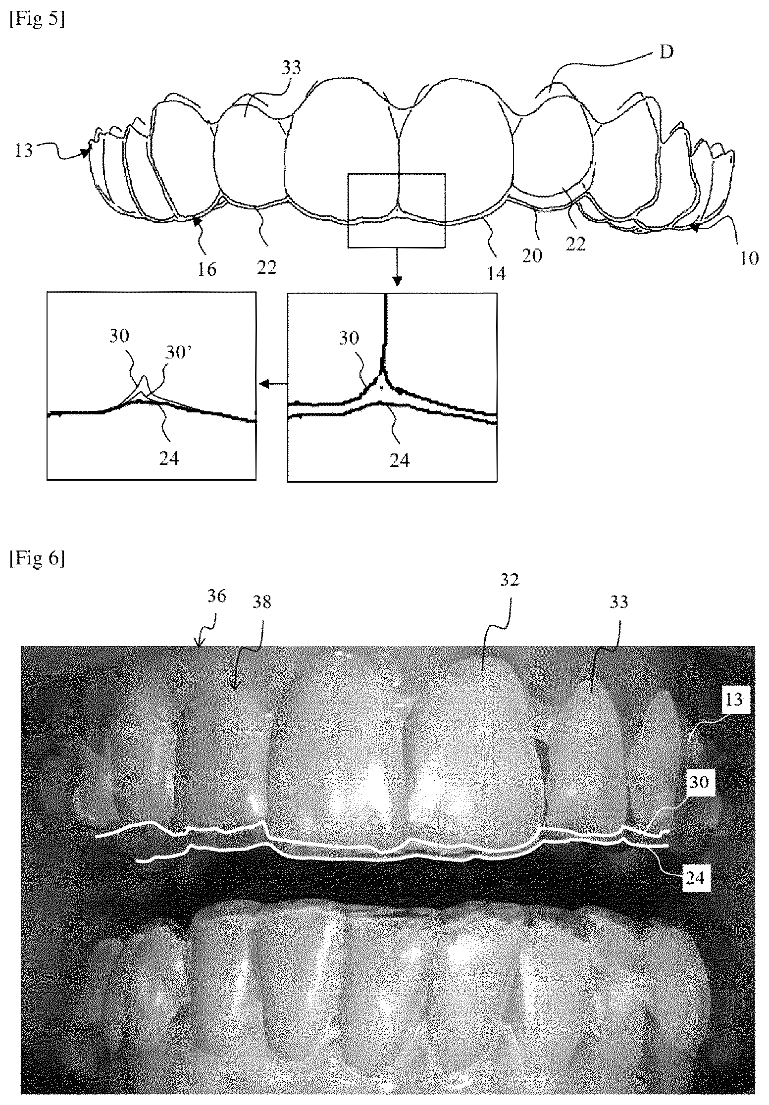 Patent US12167949 Figure 3 – Method for evaluating an orthodontic aligner