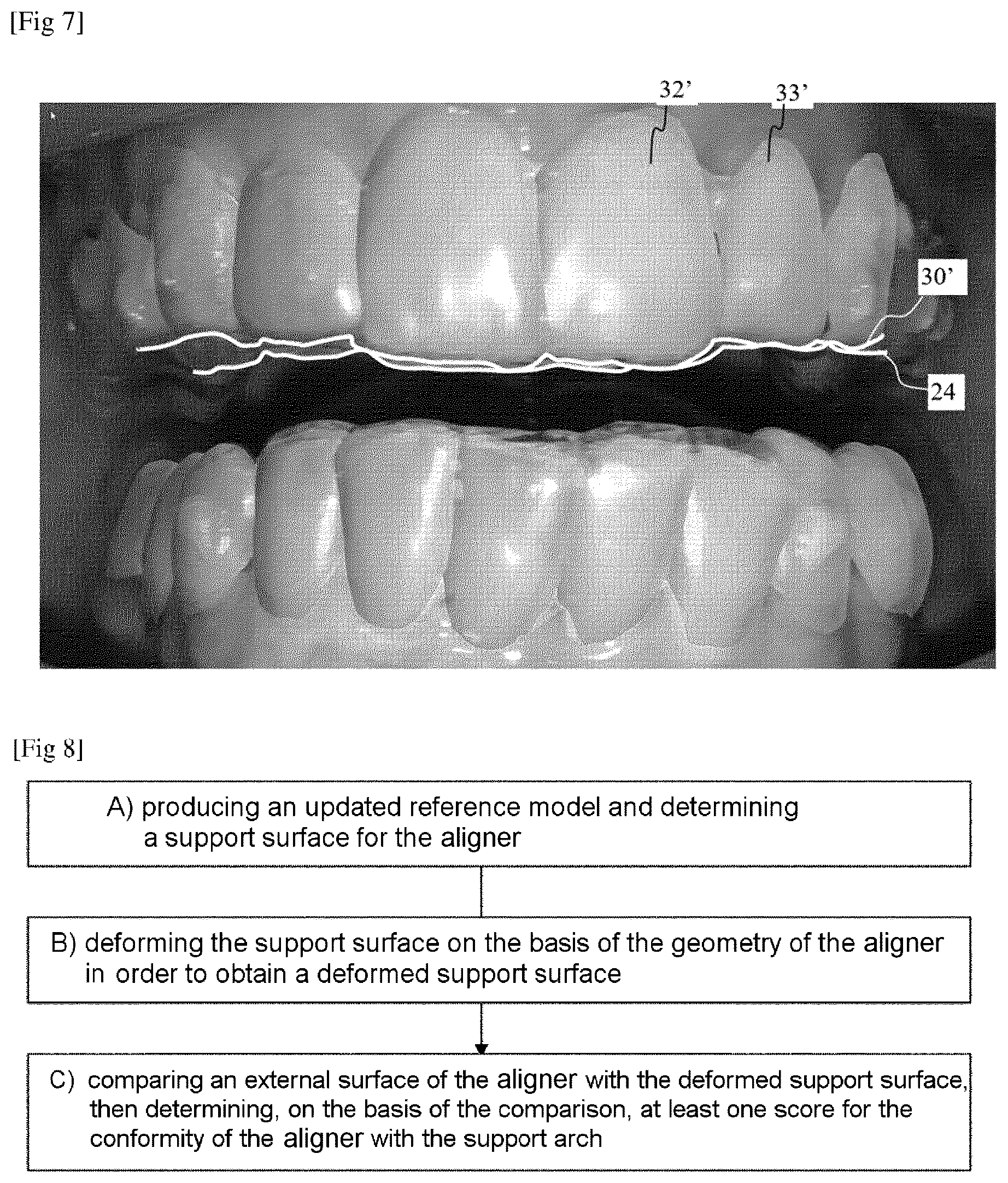 Patent US12167949 Figure 4 – Method for evaluating an orthodontic aligner