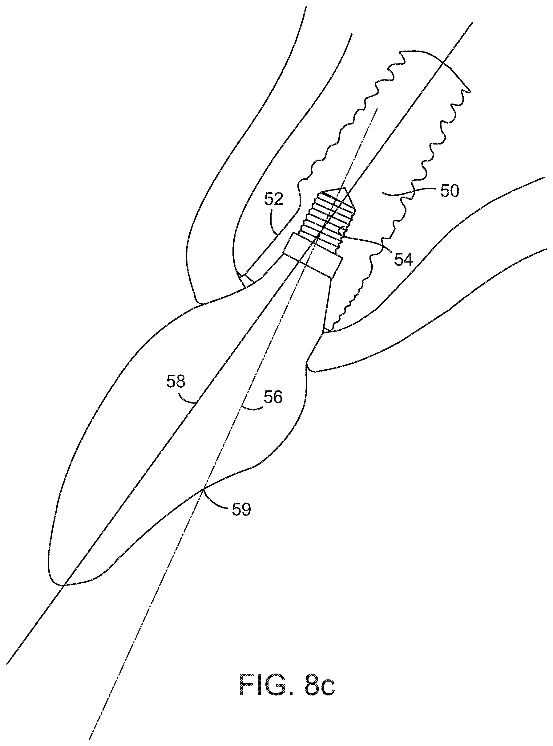 Patent US12167950 Figure 7 – Dental implant