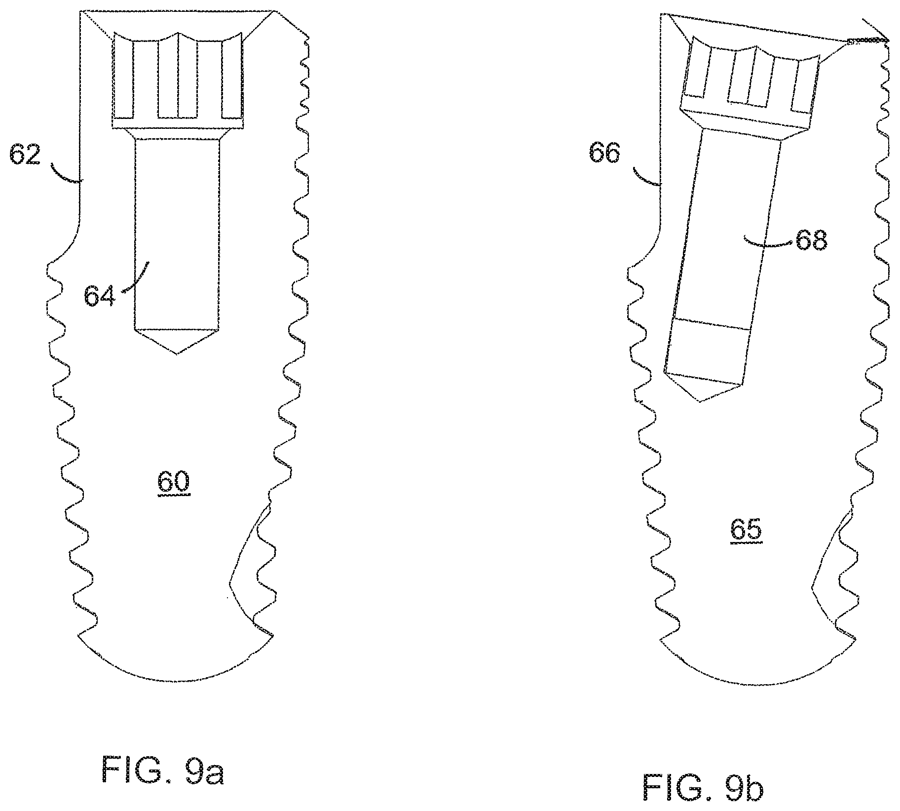Patent US12167950 Figure 8 – Dental implant