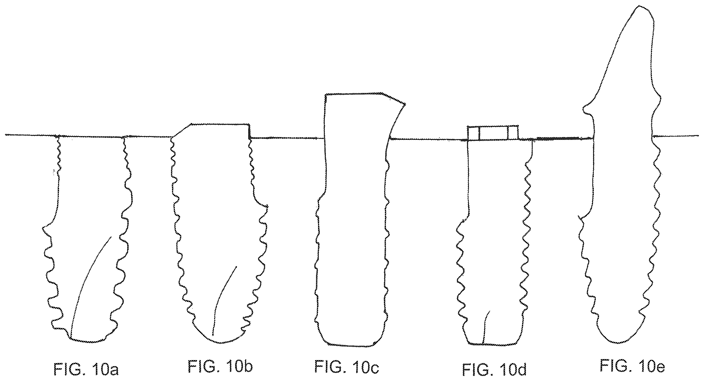Patent US12167950 Figure 10 – Dental implant