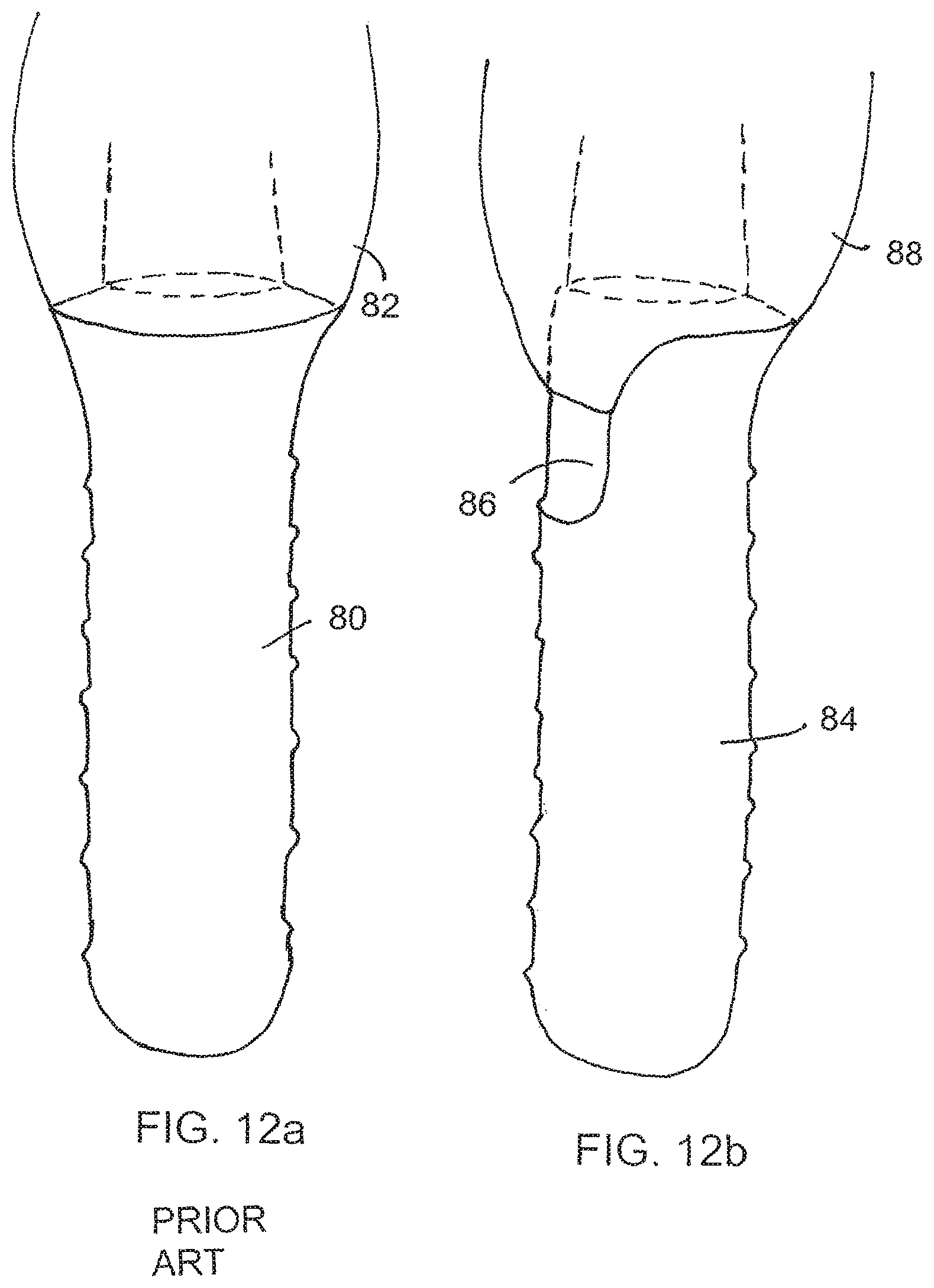 Patent US12167950 Figure 12 – Dental implant