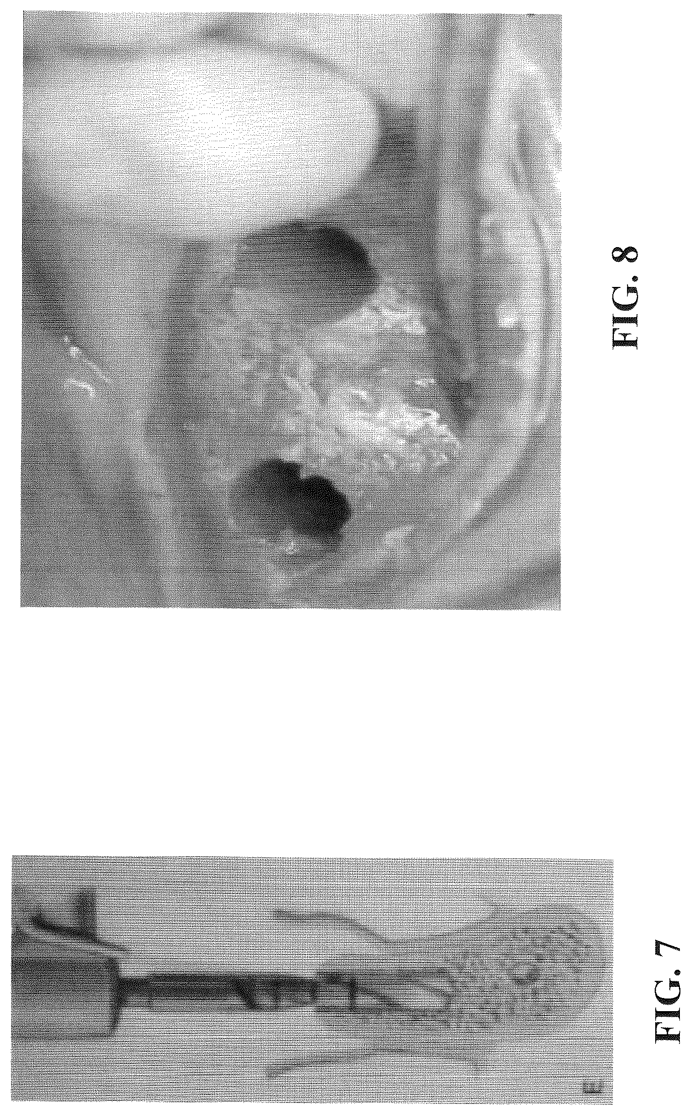 Patent US12167951 Figure 3 – Osteotomy drill bit to produce an optimally shaped jawbone opening for a dental implant and abutment