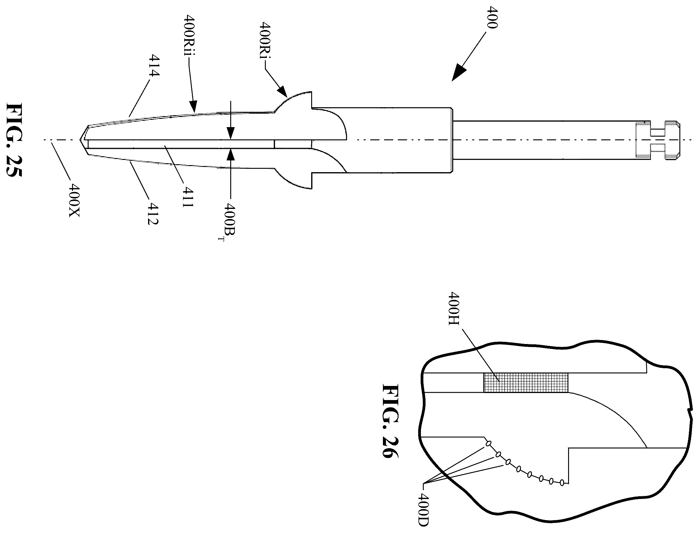 Patent US12167951 Figure 13 – Osteotomy drill bit to produce an optimally shaped jawbone opening for a dental implant and abutment