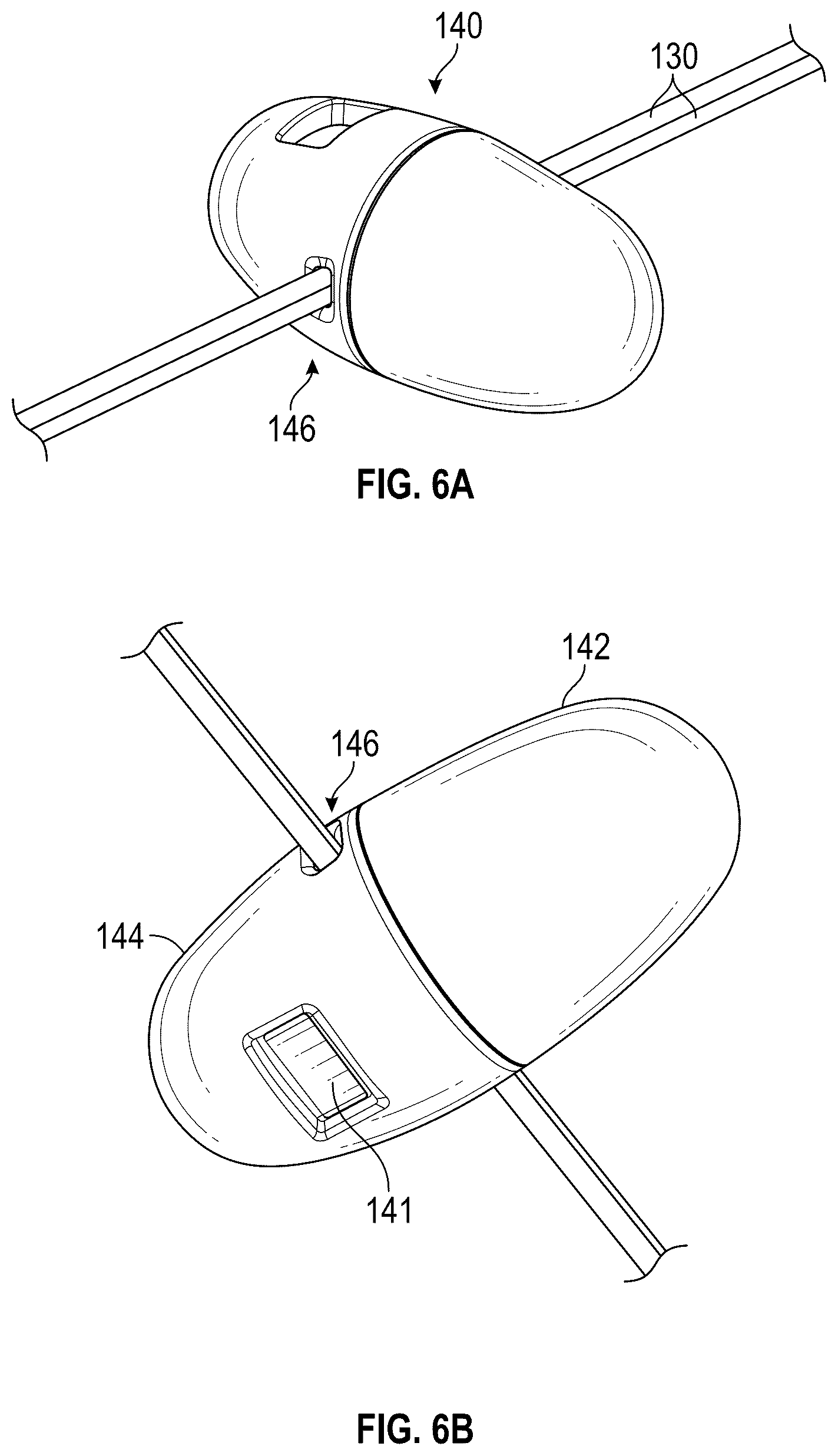 Patent US12167954 Figure 6 – Systems and methods for treating stress urinary incontinence