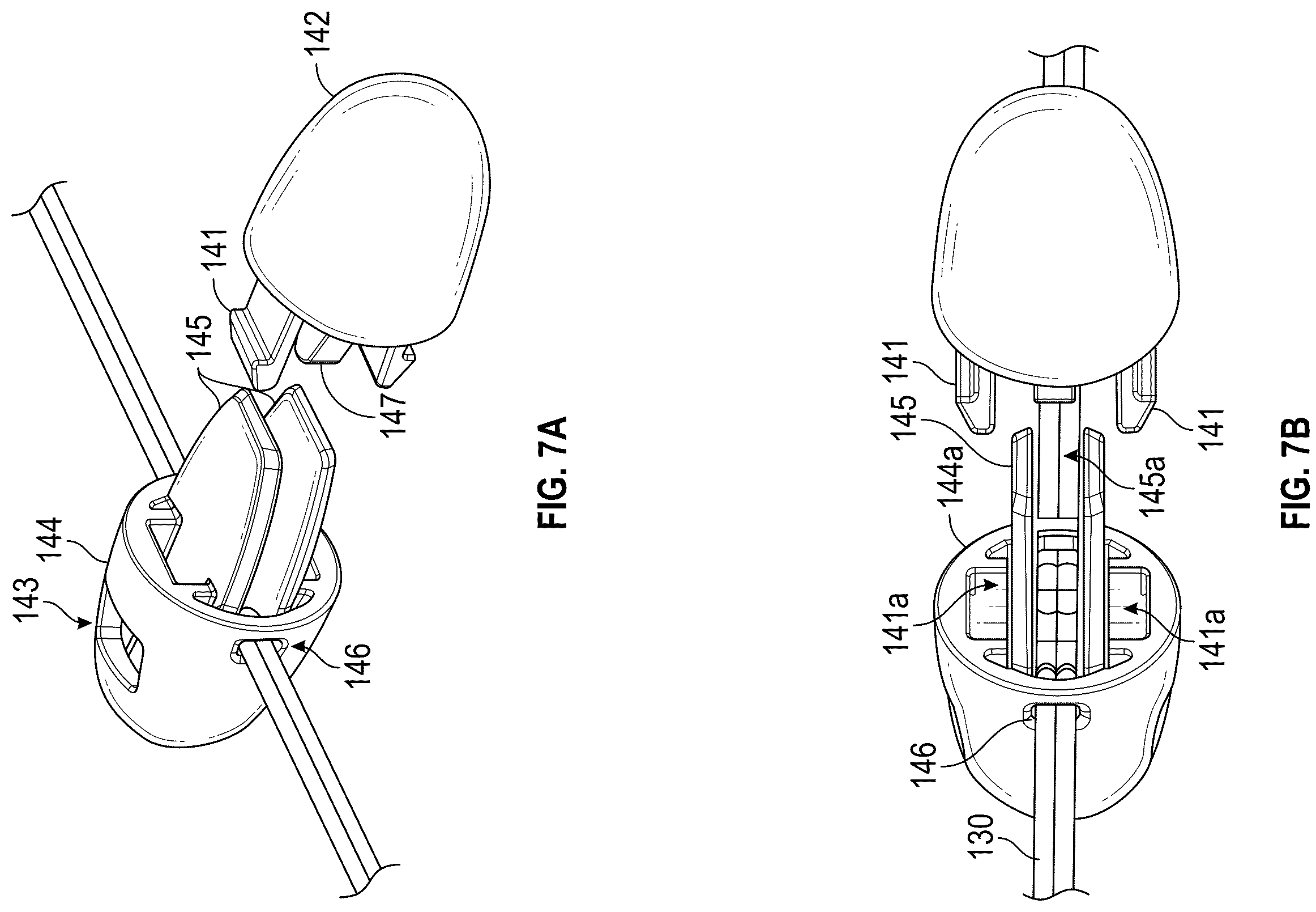 Patent US12167954 Figure 7 – Systems and methods for treating stress urinary incontinence