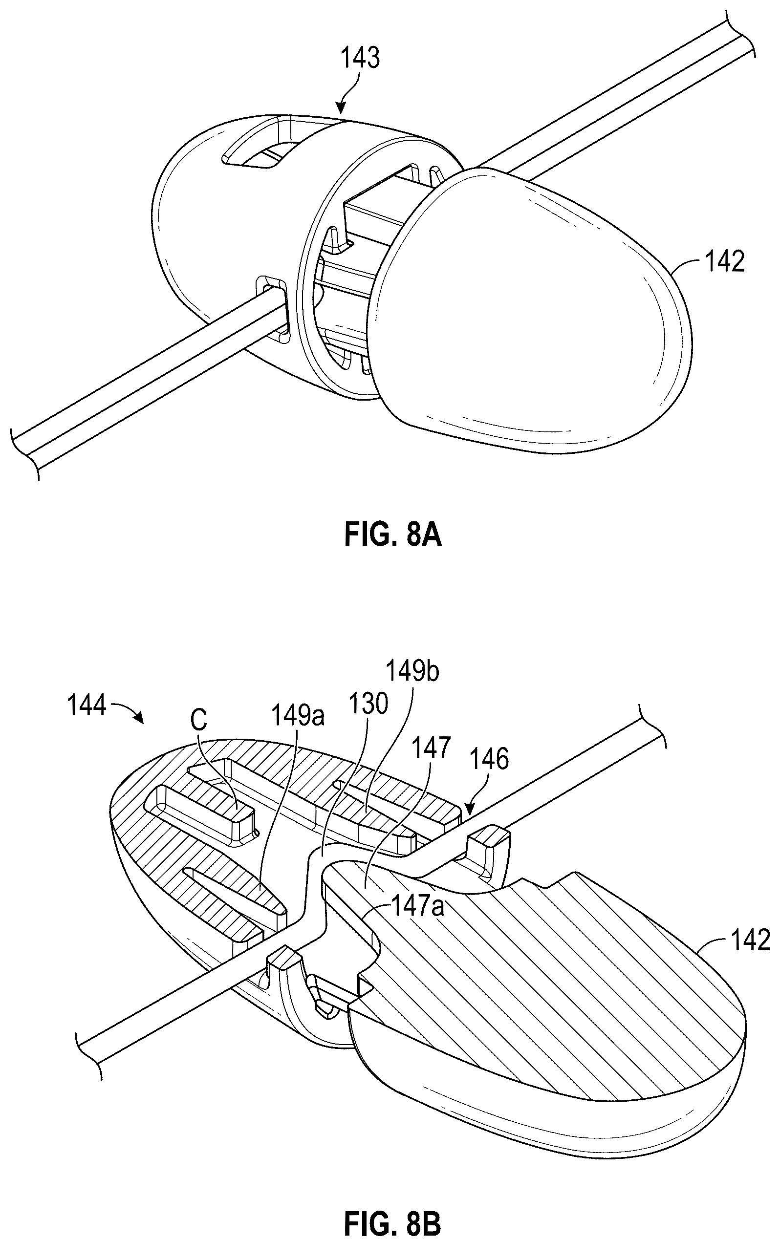 Patent US12167954 Figure 8 – Systems and methods for treating stress urinary incontinence