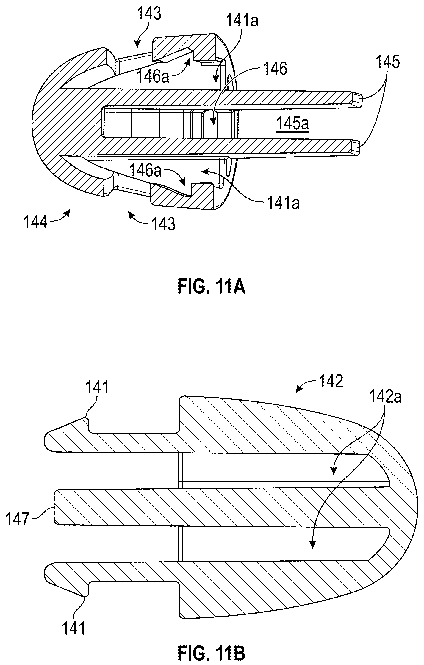 Patent US12167954 Figure 11 – Systems and methods for treating stress urinary incontinence