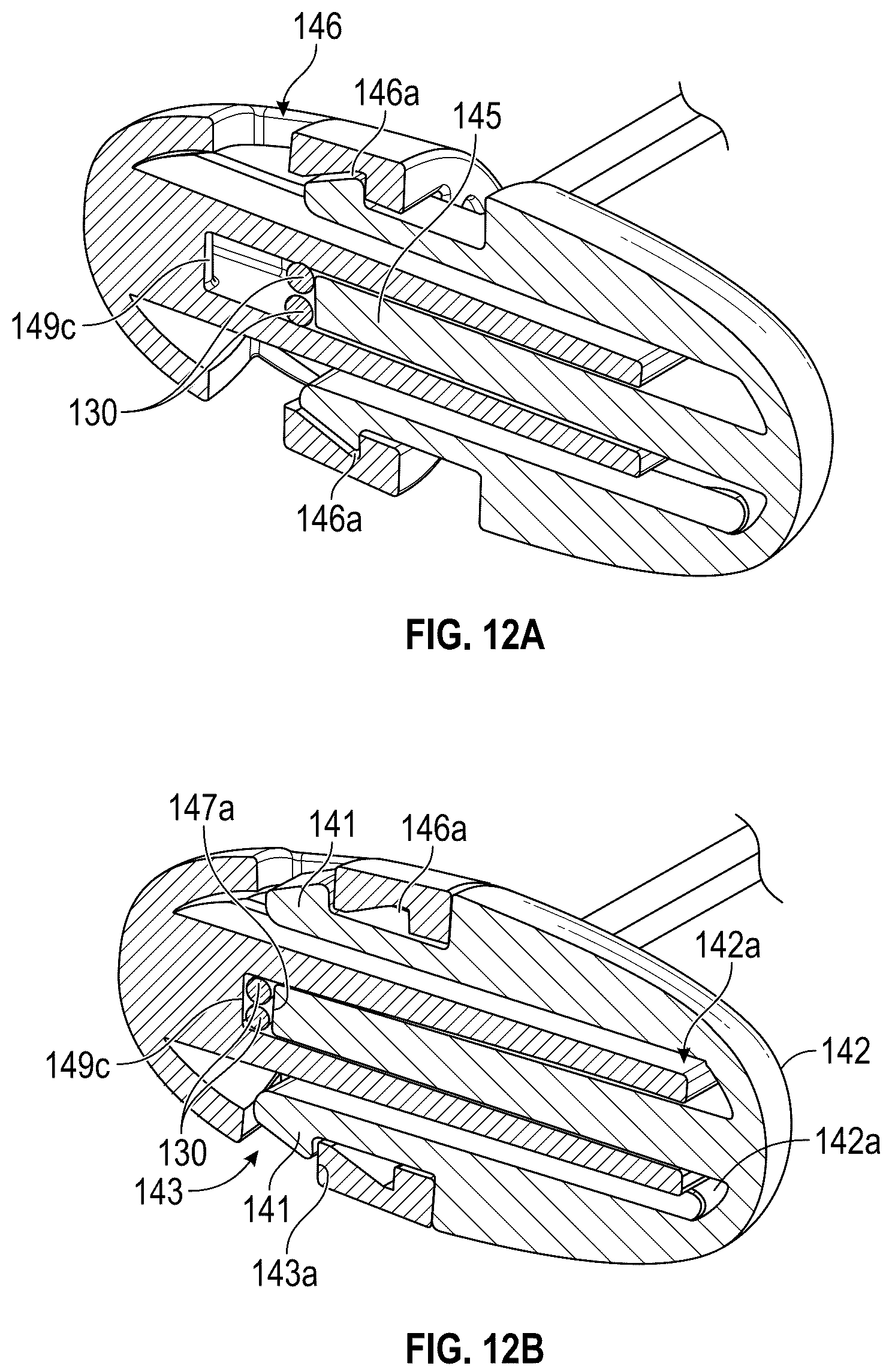 Patent US12167954 Figure 12 – Systems and methods for treating stress urinary incontinence