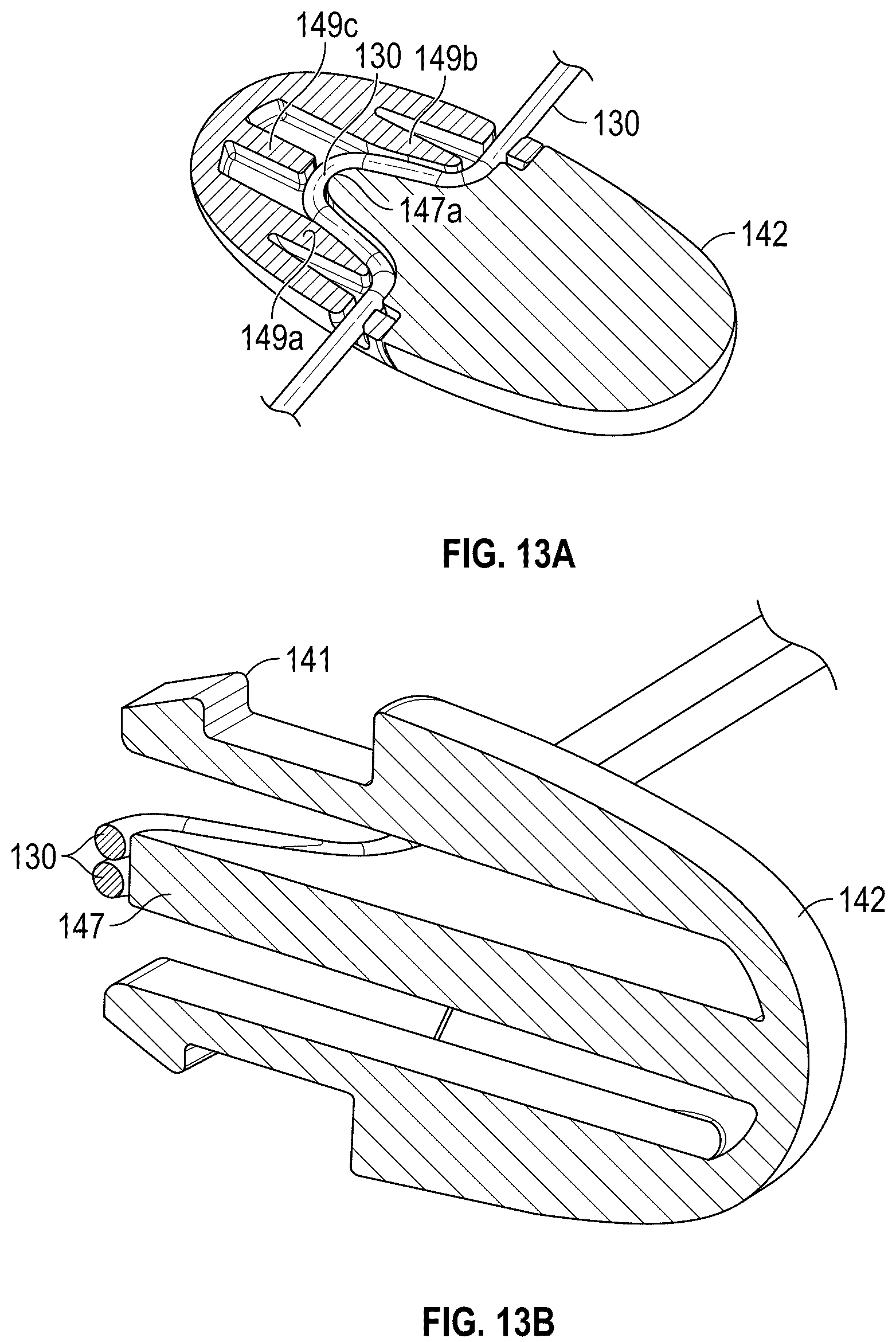 Patent US12167954 Figure 13 – Systems and methods for treating stress urinary incontinence