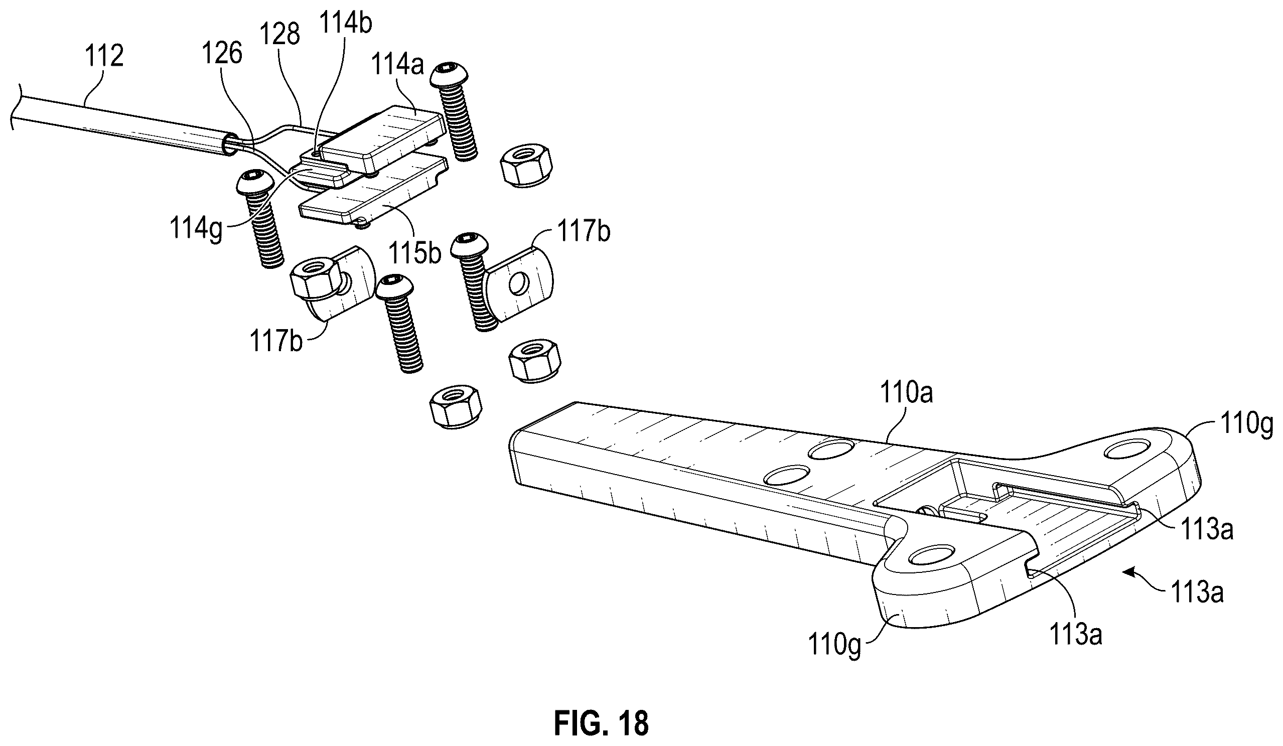 Patent US12167954 Figure 18 – Systems and methods for treating stress urinary incontinence