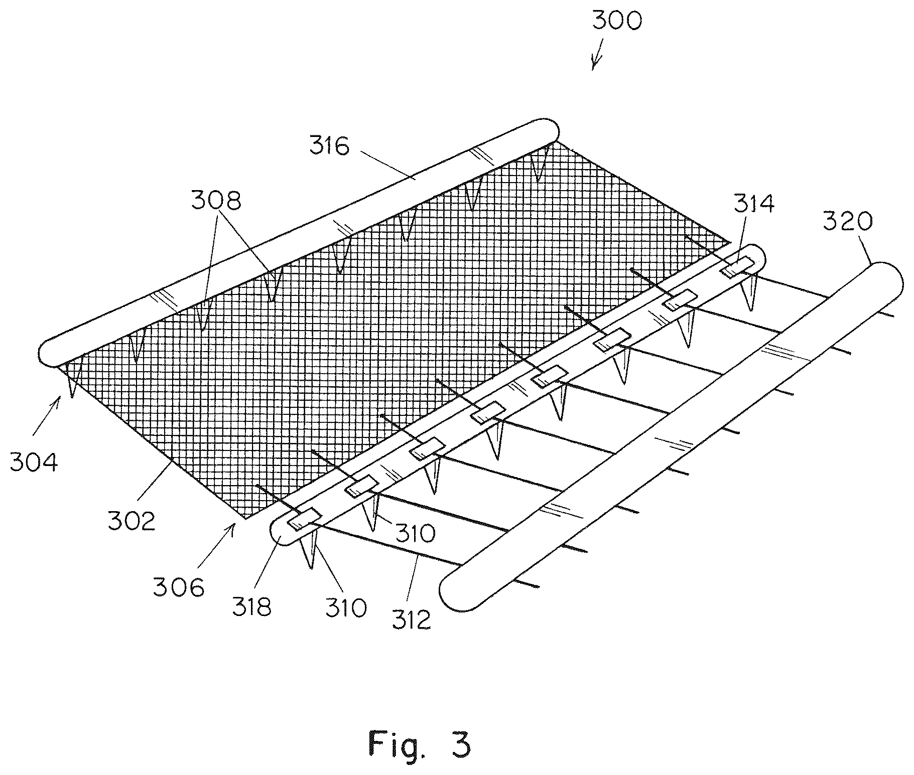 Patent US12167955 Figure 3 – Surgical prosthetic