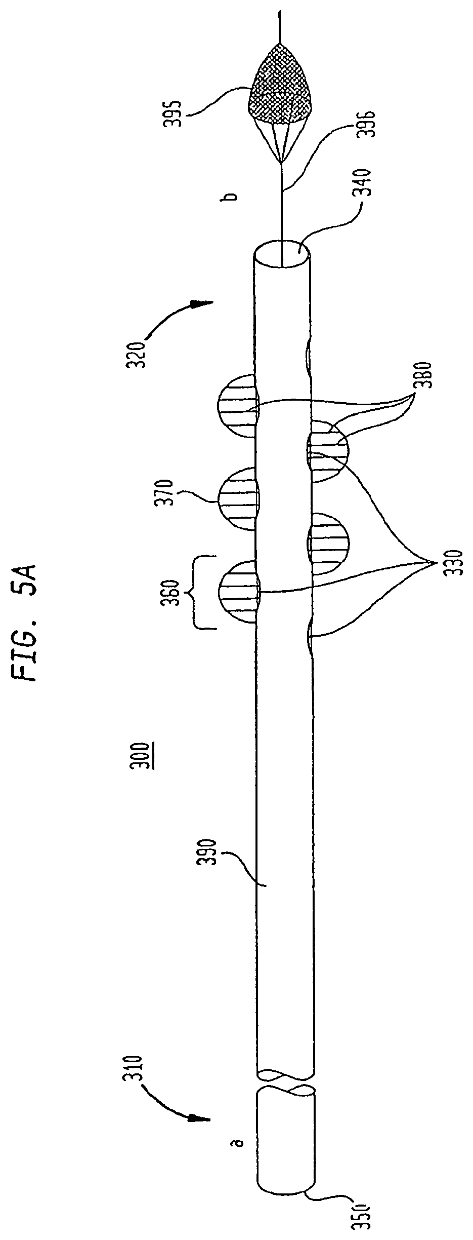 Patent US12167956 Figure 5 – Lasso filter tipped microcatheter for simultaneous rotating separator, irrigator for thrombectomy and method for use