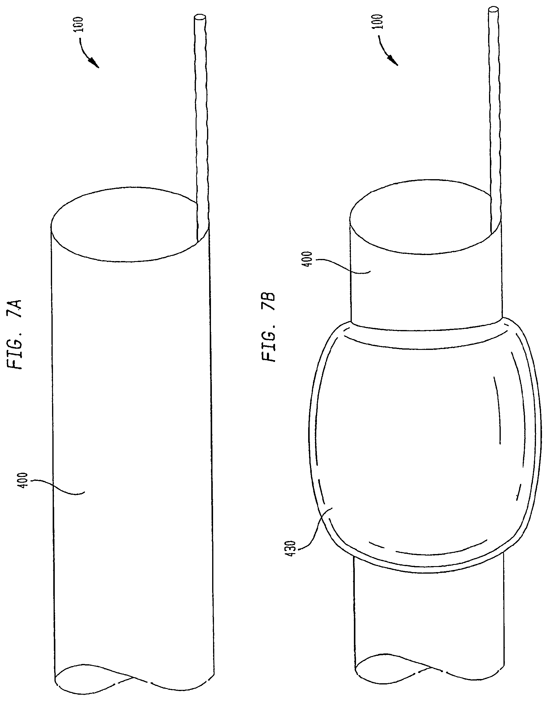 Patent US12167956 Figure 9 – Lasso filter tipped microcatheter for simultaneous rotating separator, irrigator for thrombectomy and method for use