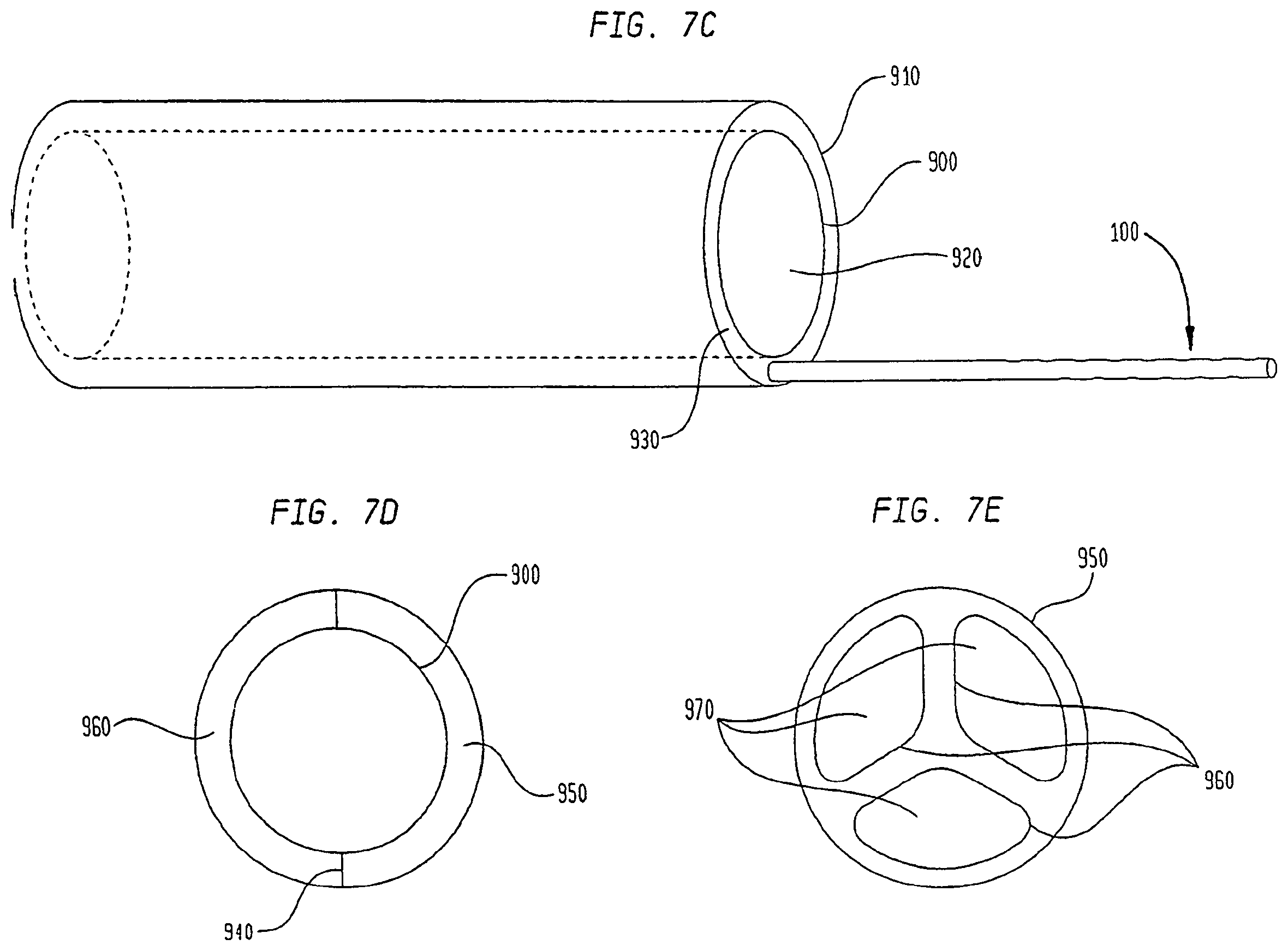Patent US12167956 Figure 10 – Lasso filter tipped microcatheter for simultaneous rotating separator, irrigator for thrombectomy and method for use