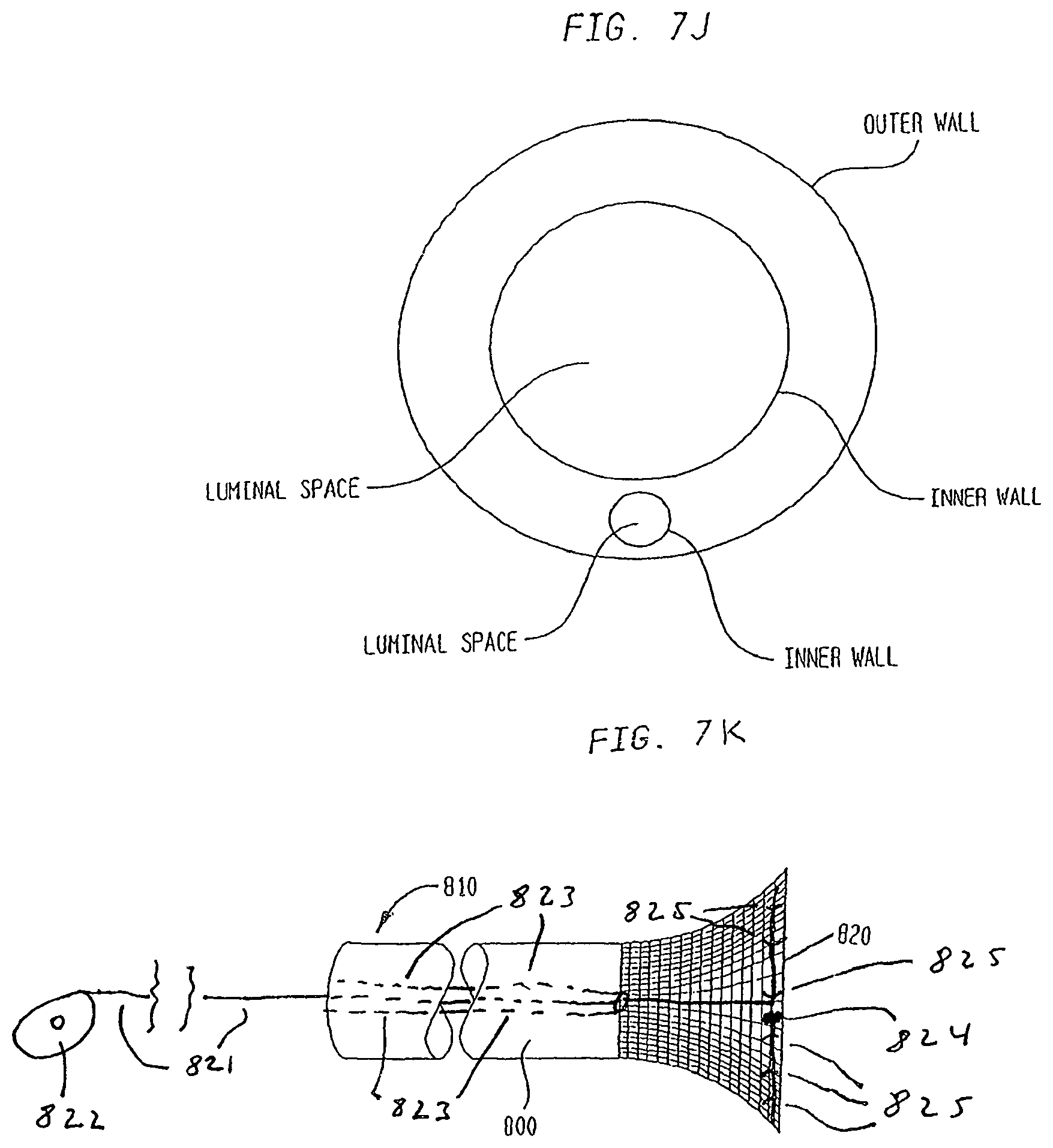 Patent US12167956 Figure 12 – Lasso filter tipped microcatheter for simultaneous rotating separator, irrigator for thrombectomy and method for use