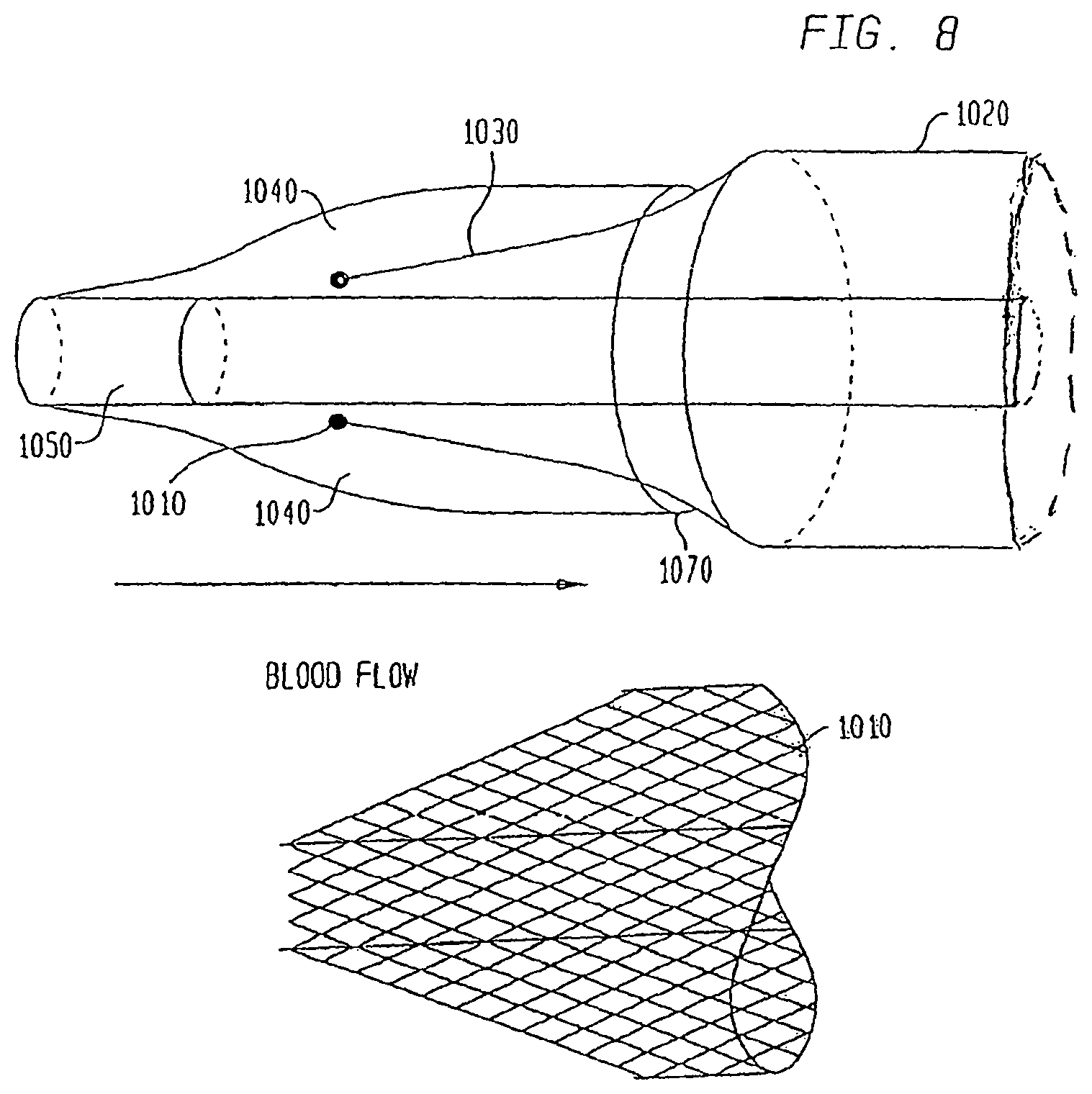 Patent US12167956 Figure 13 – Lasso filter tipped microcatheter for simultaneous rotating separator, irrigator for thrombectomy and method for use