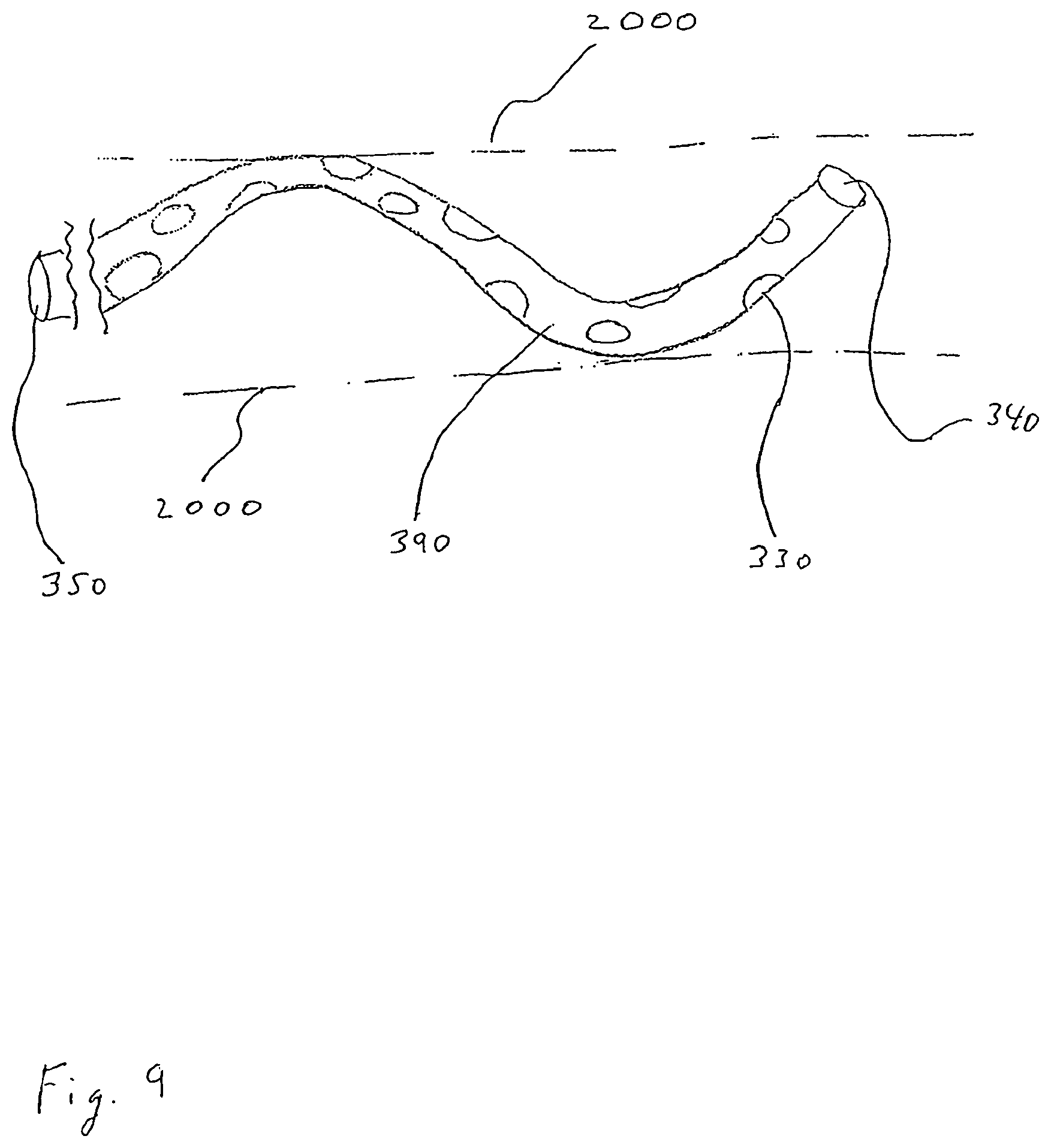 Patent US12167956 Figure 14 – Lasso filter tipped microcatheter for simultaneous rotating separator, irrigator for thrombectomy and method for use