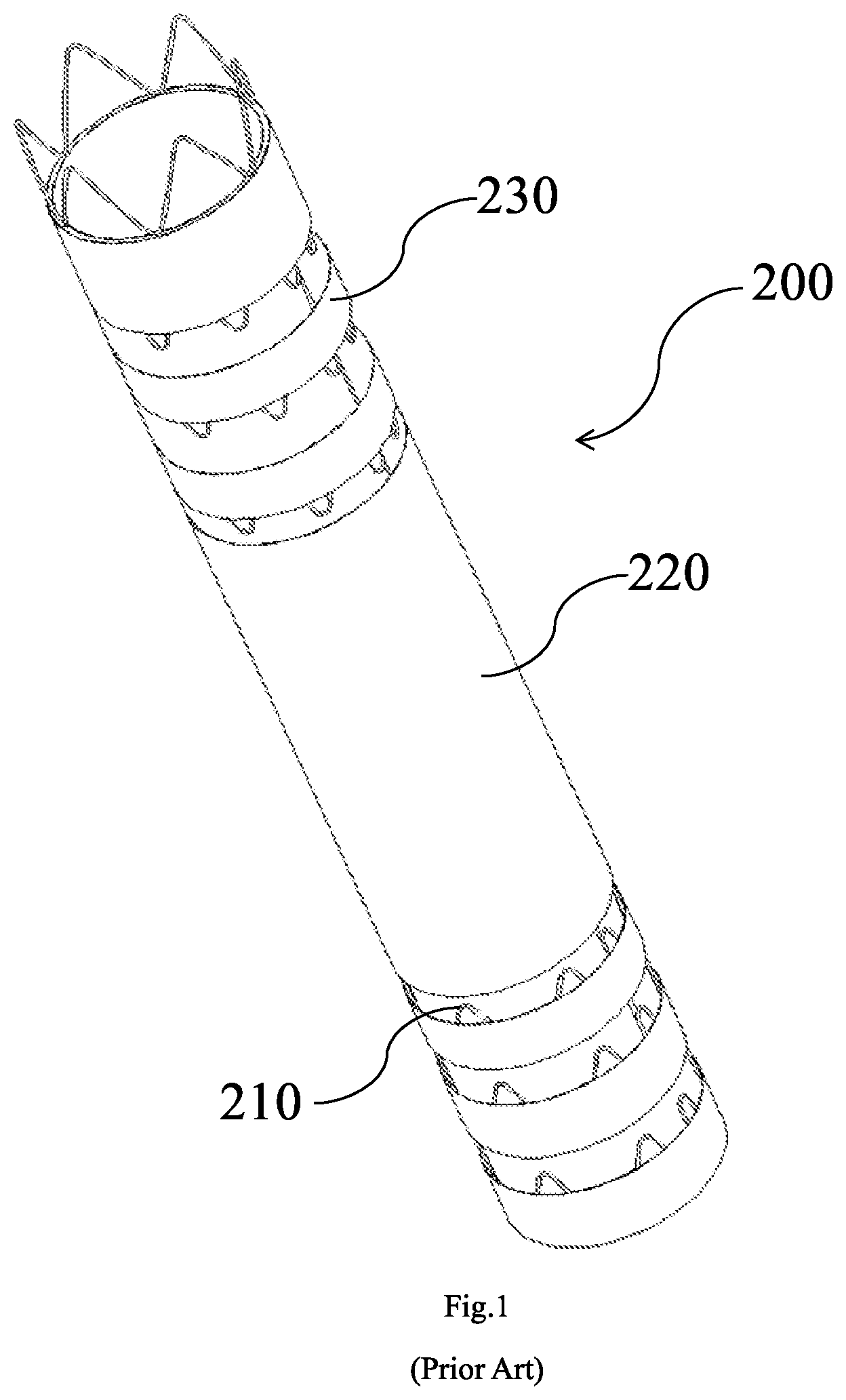 Patent US12167957 Figure 1 – Stent graft
