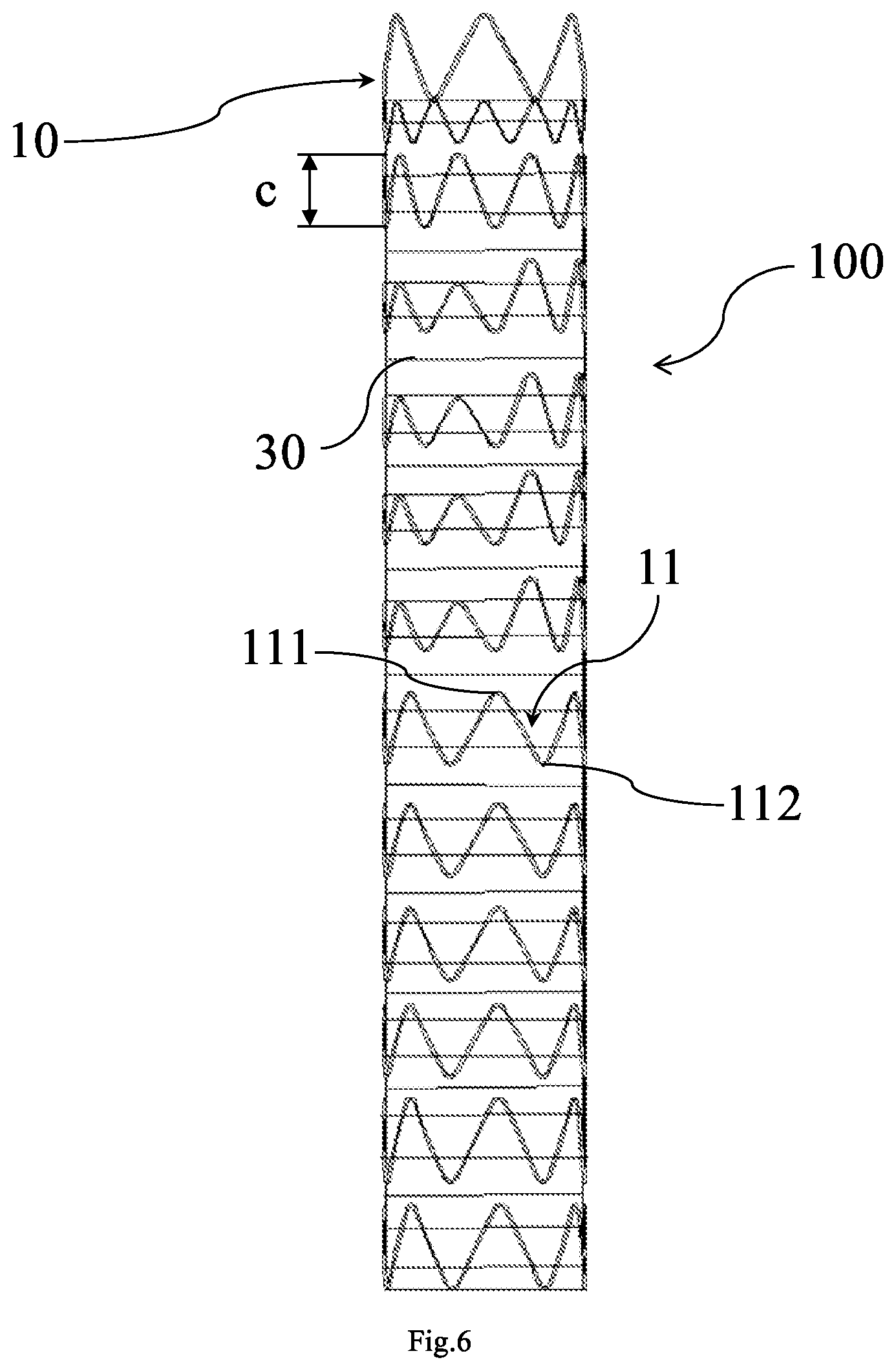 Patent US12167957 Figure 6 – Stent graft