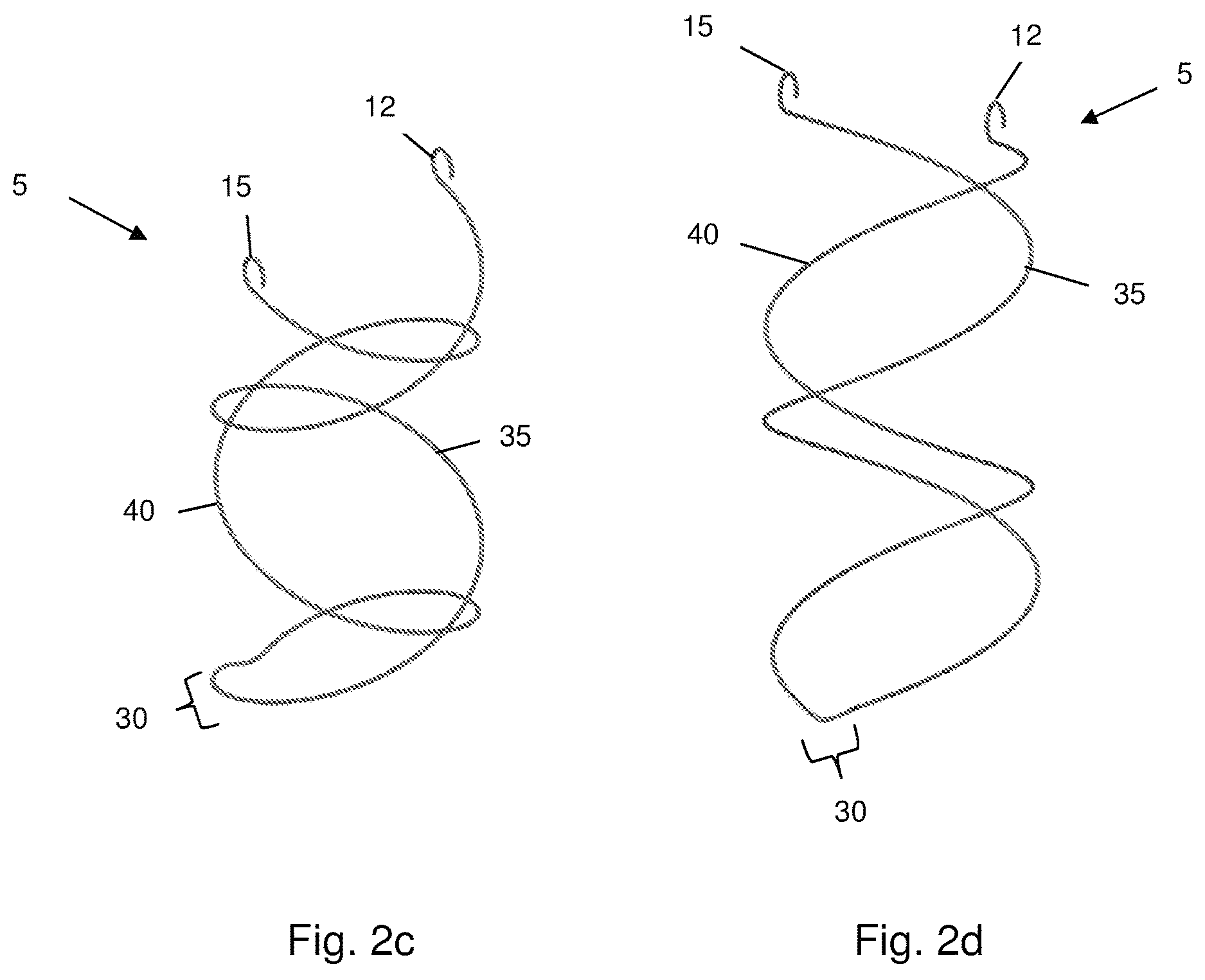 Patent US12167958 Figure 3 – Multi-spiral self-expanding stent and methods of making and using the same