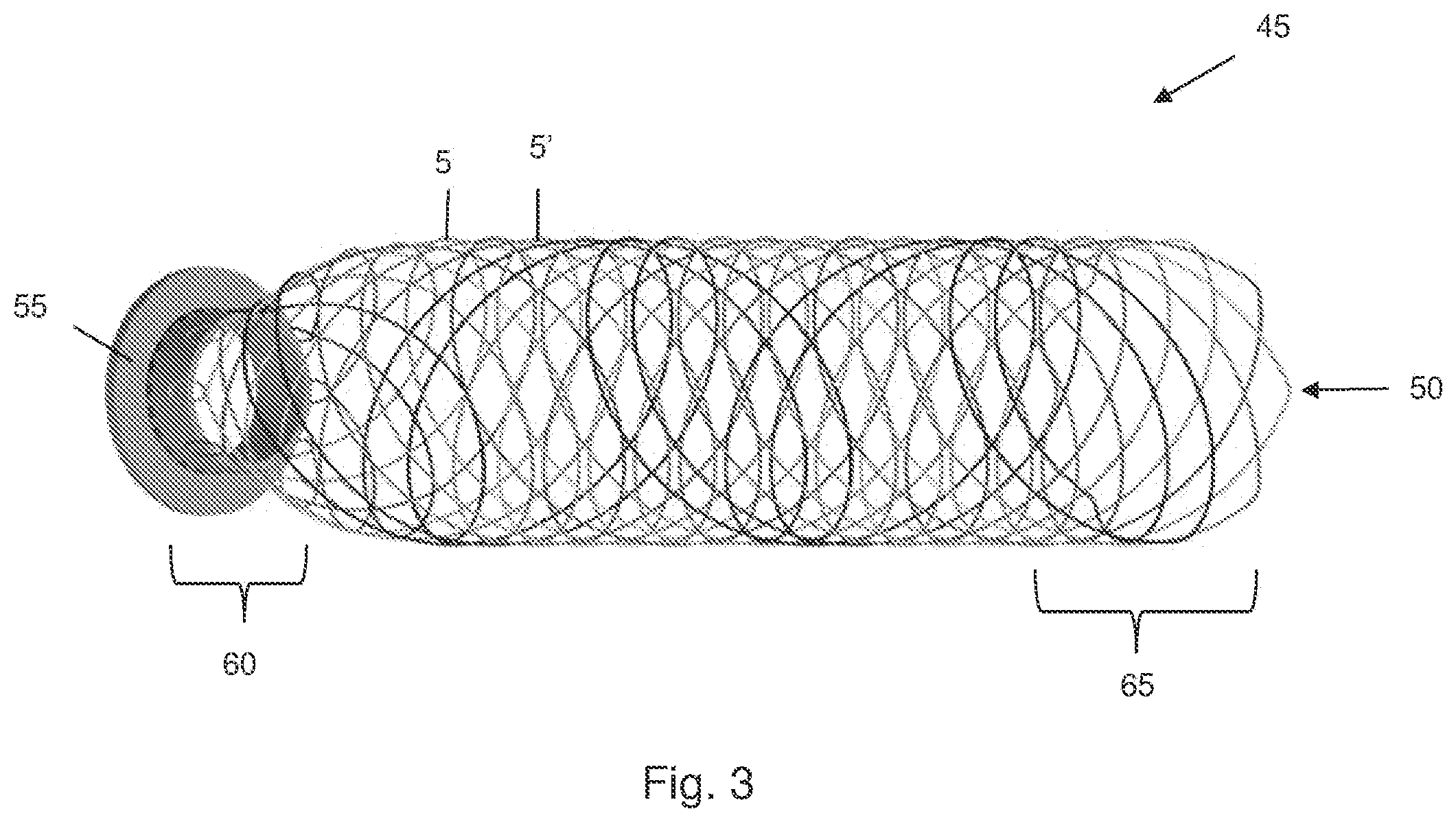 Patent US12167958 Figure 4 – Multi-spiral self-expanding stent and methods of making and using the same