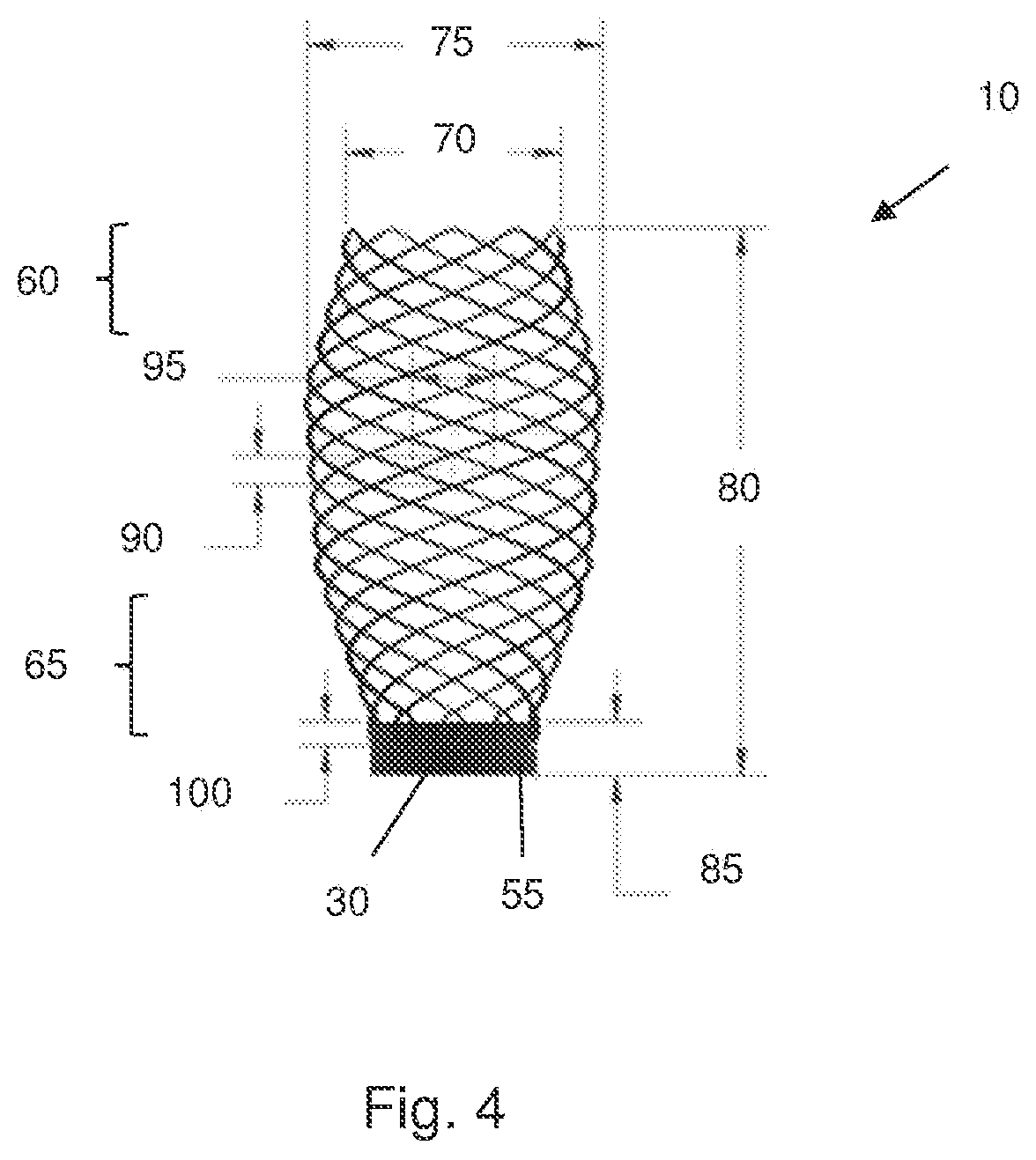 Patent US12167958 Figure 5 – Multi-spiral self-expanding stent and methods of making and using the same