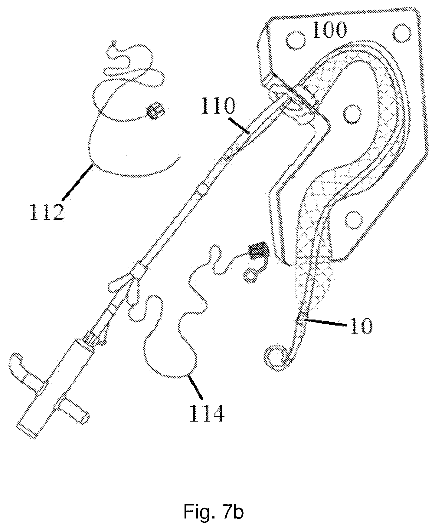 Patent US12167958 Figure 9 – Multi-spiral self-expanding stent and methods of making and using the same