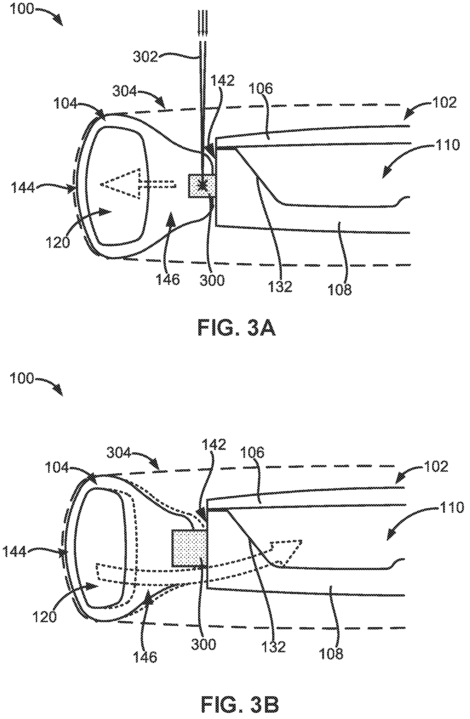 Patent US12167959 Figure 5 – Adjustable intraocular lenses and methods of post-operatively adjusting intraocular lenses