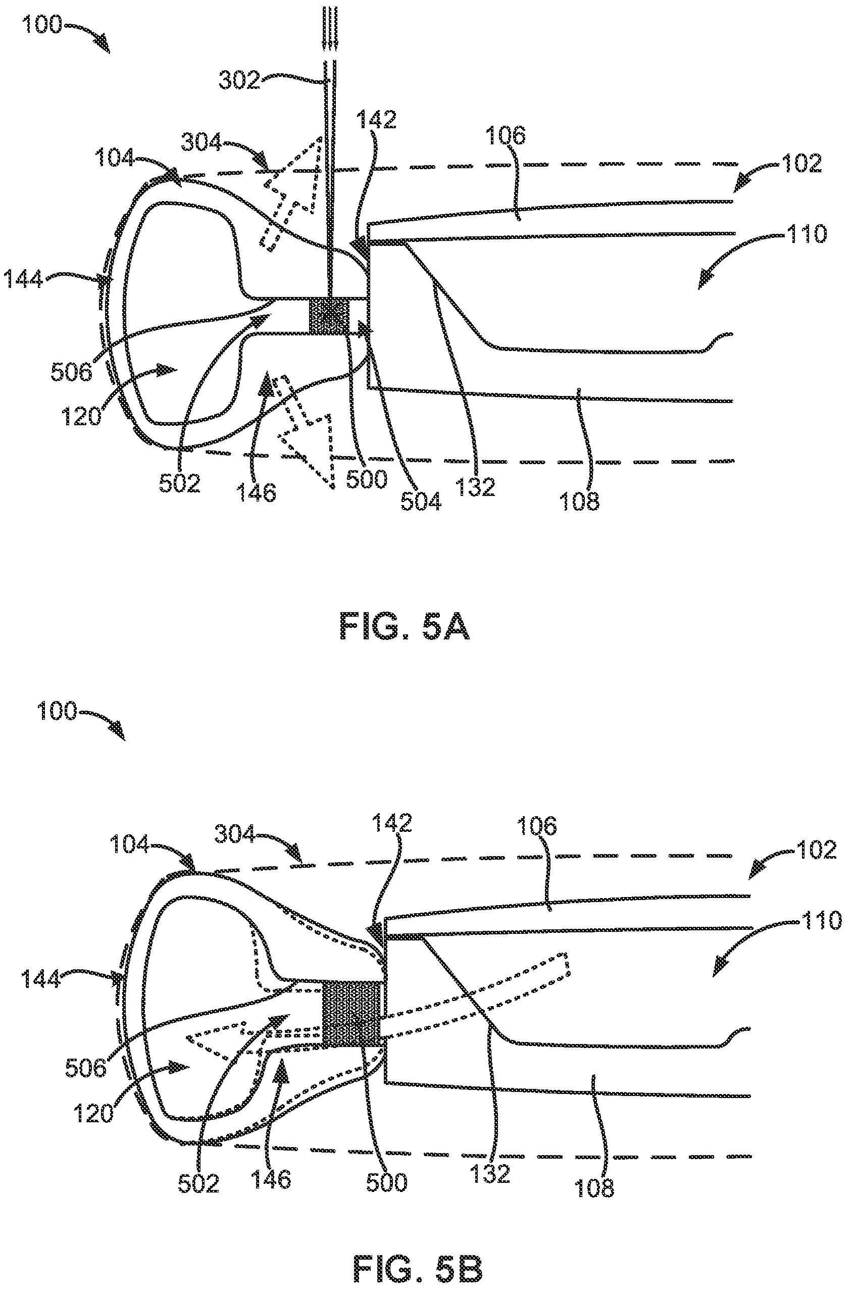Patent US12167959 Figure 7 – Adjustable intraocular lenses and methods of post-operatively adjusting intraocular lenses