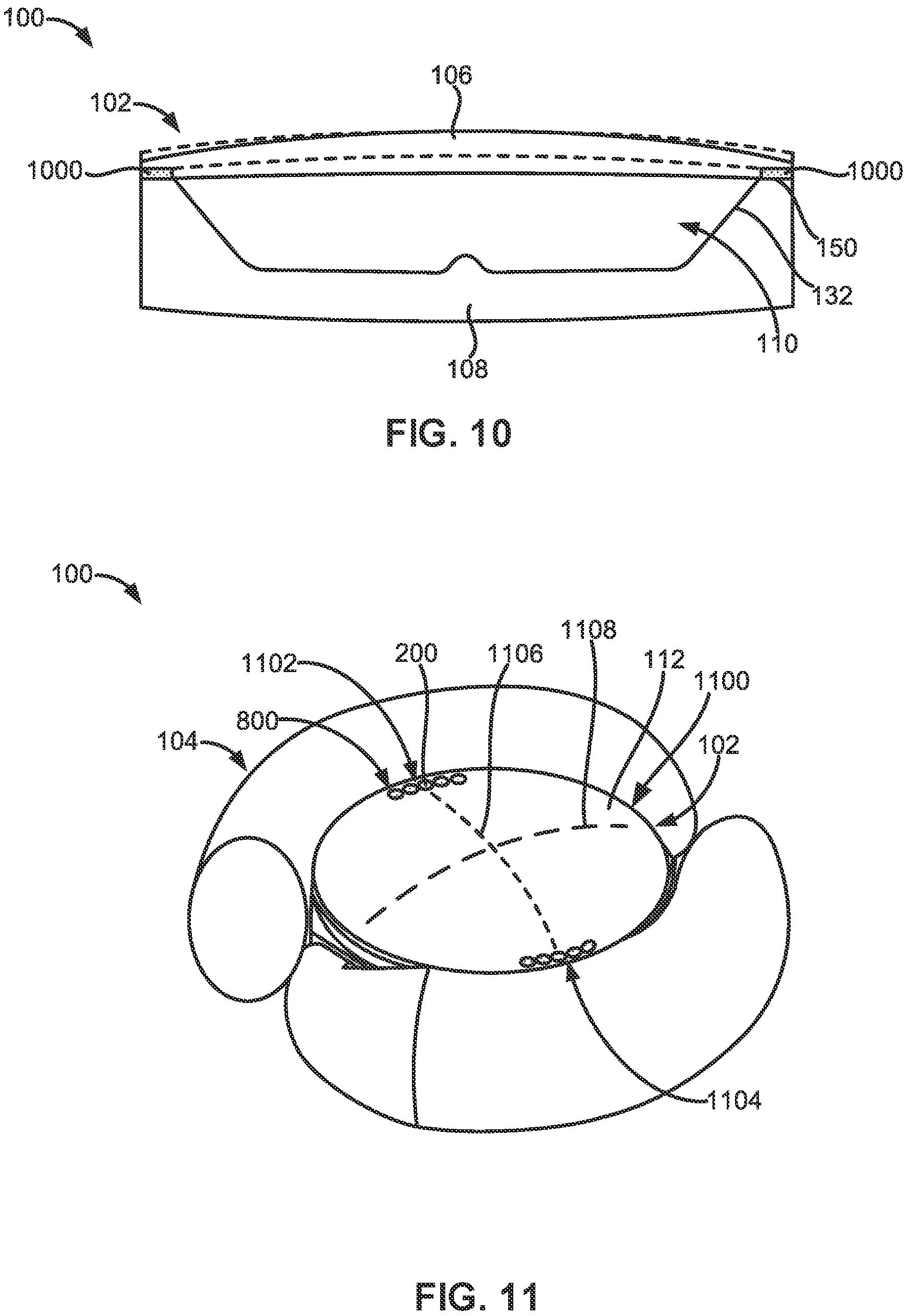 Patent US12167959 Figure 11 – Adjustable intraocular lenses and methods of post-operatively adjusting intraocular lenses