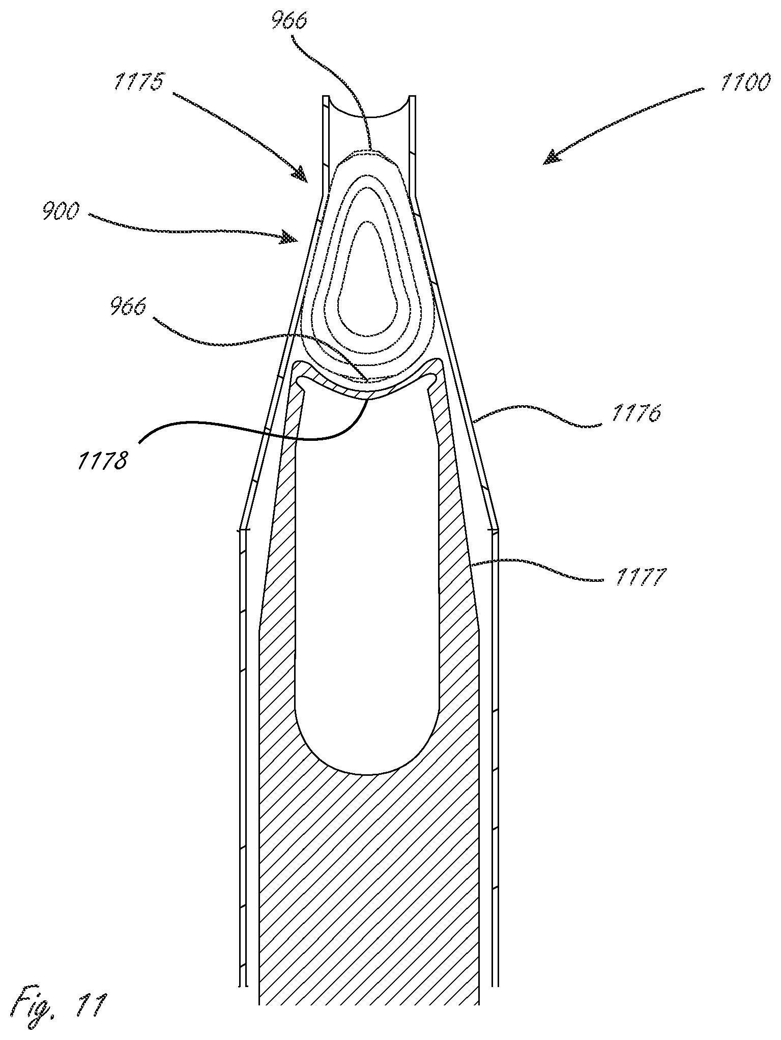 Patent US12167960 Figure 11 – Multi-piece accommodating intraocular lenses and methods for making and using same