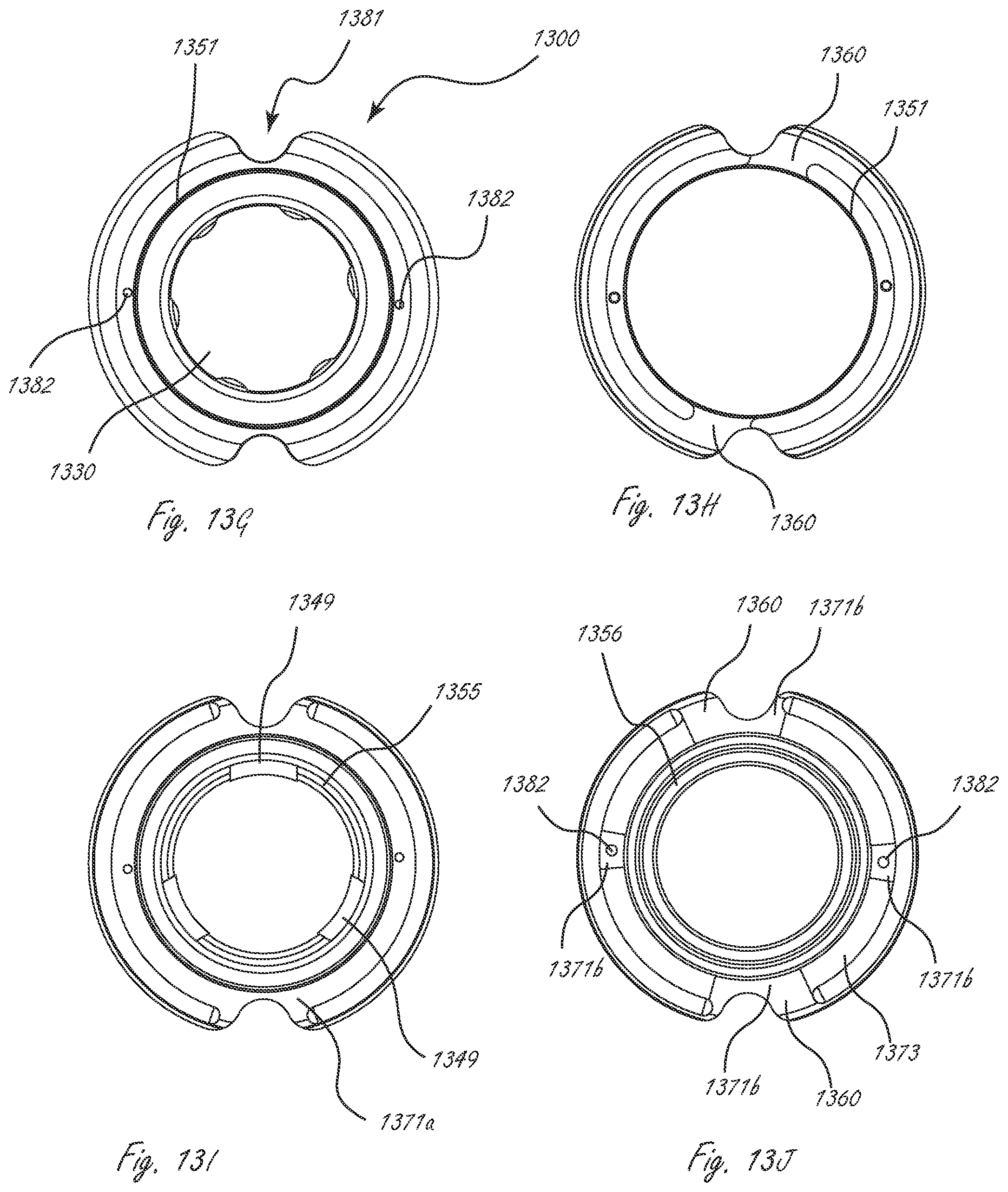 Patent US12167960 Figure 14 – Multi-piece accommodating intraocular lenses and methods for making and using same
